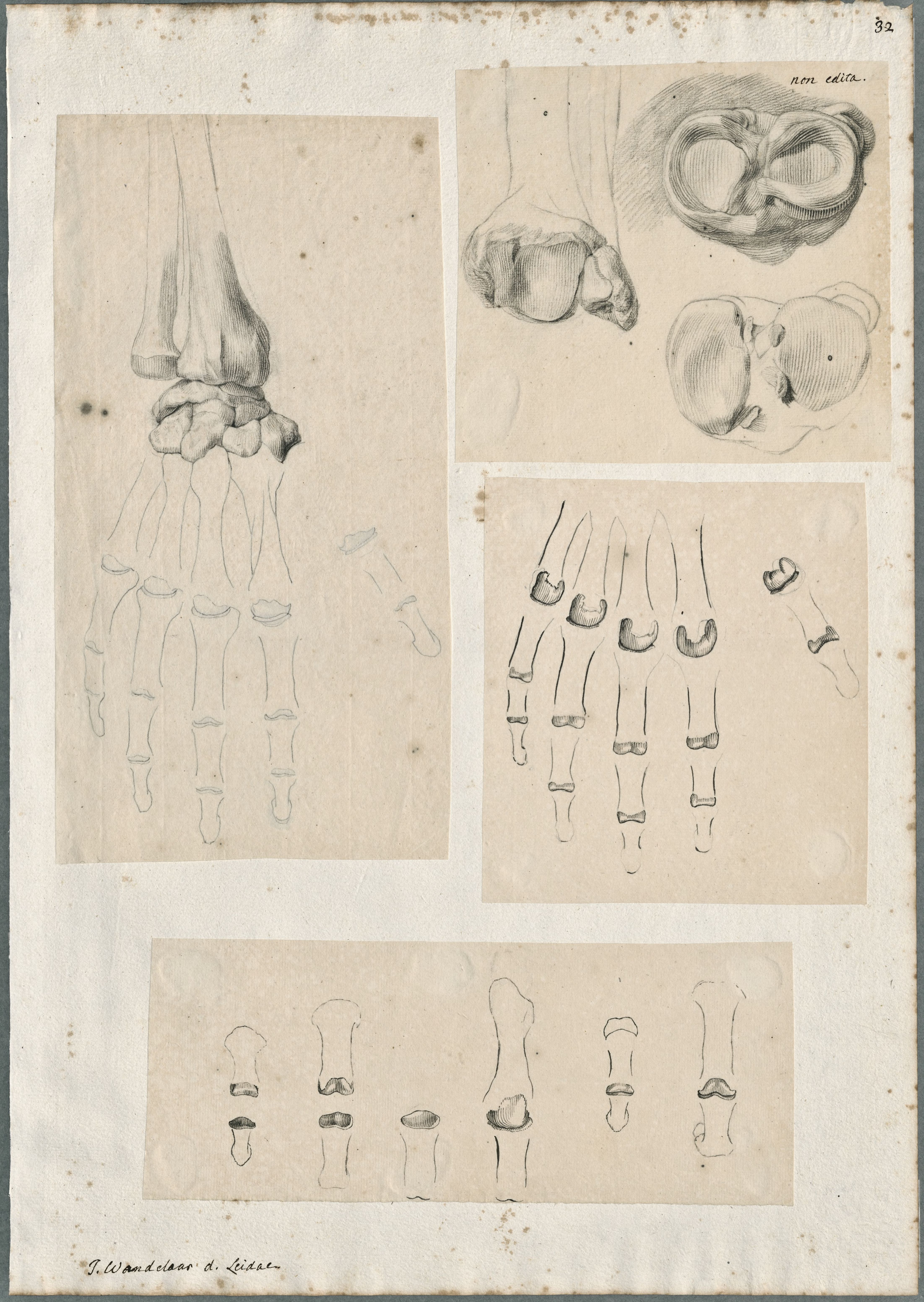 Anatomical drawings: bones of the hand and wrist