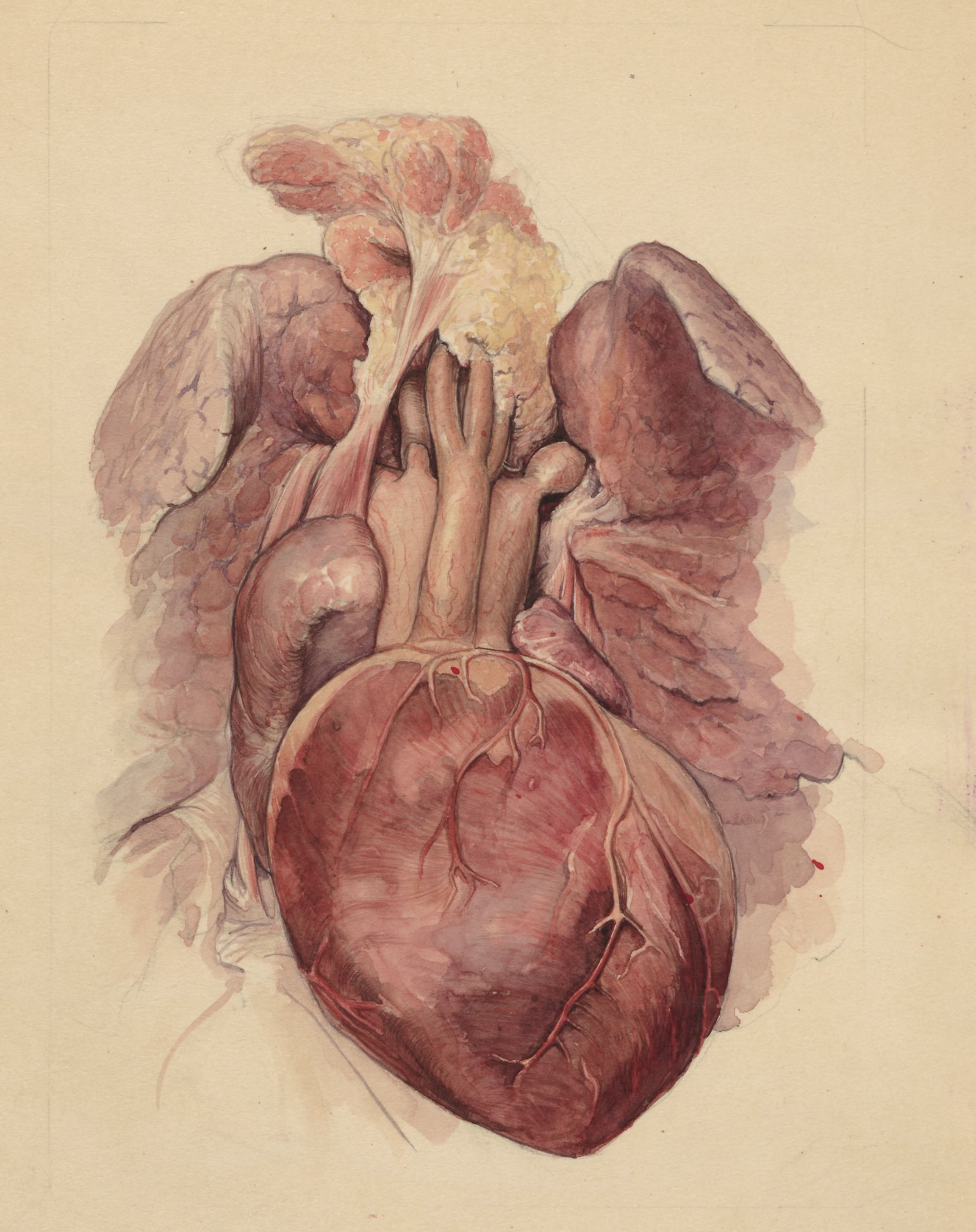 Tetralogy of Fallot (heart)