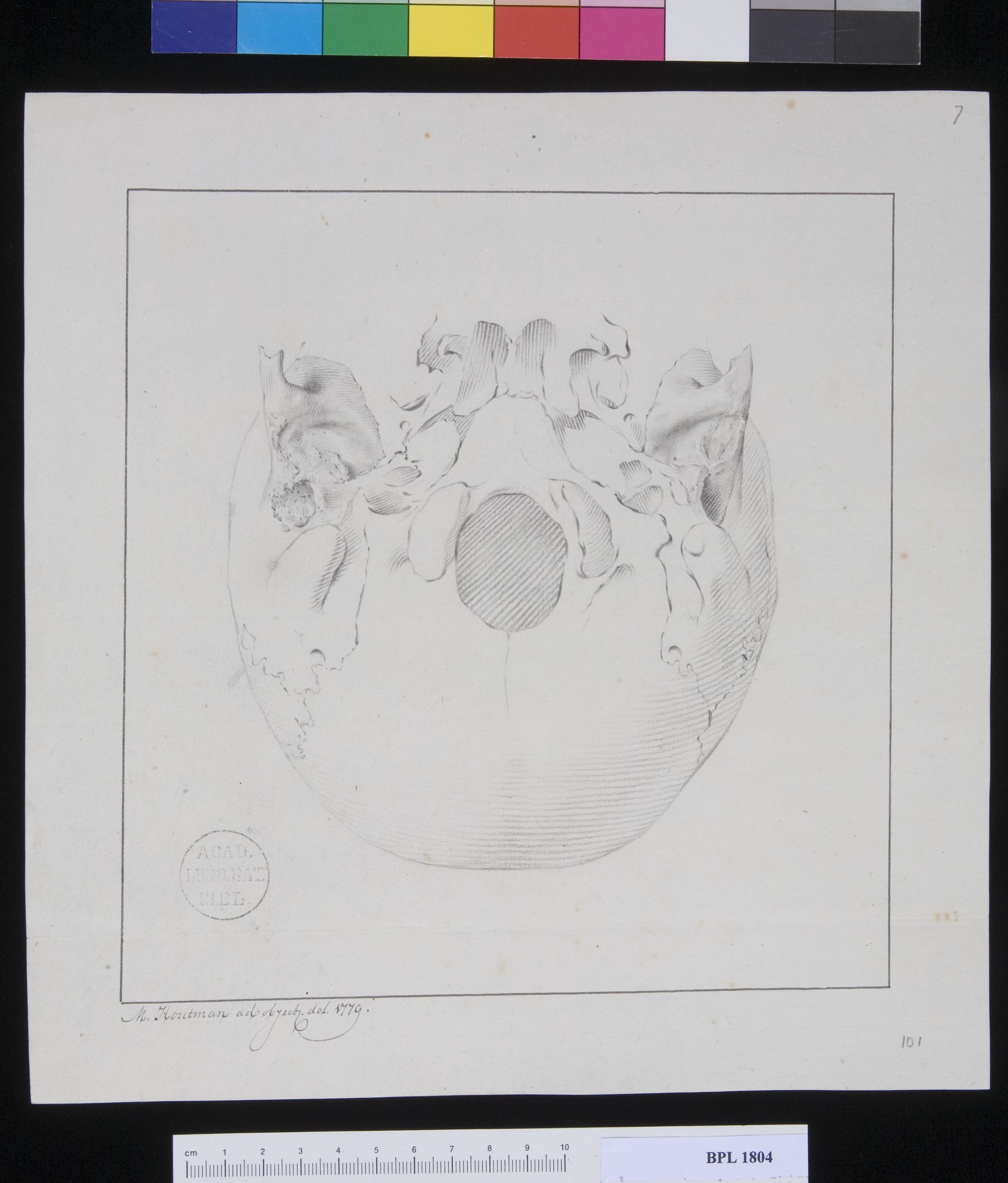 Pathology, fractures