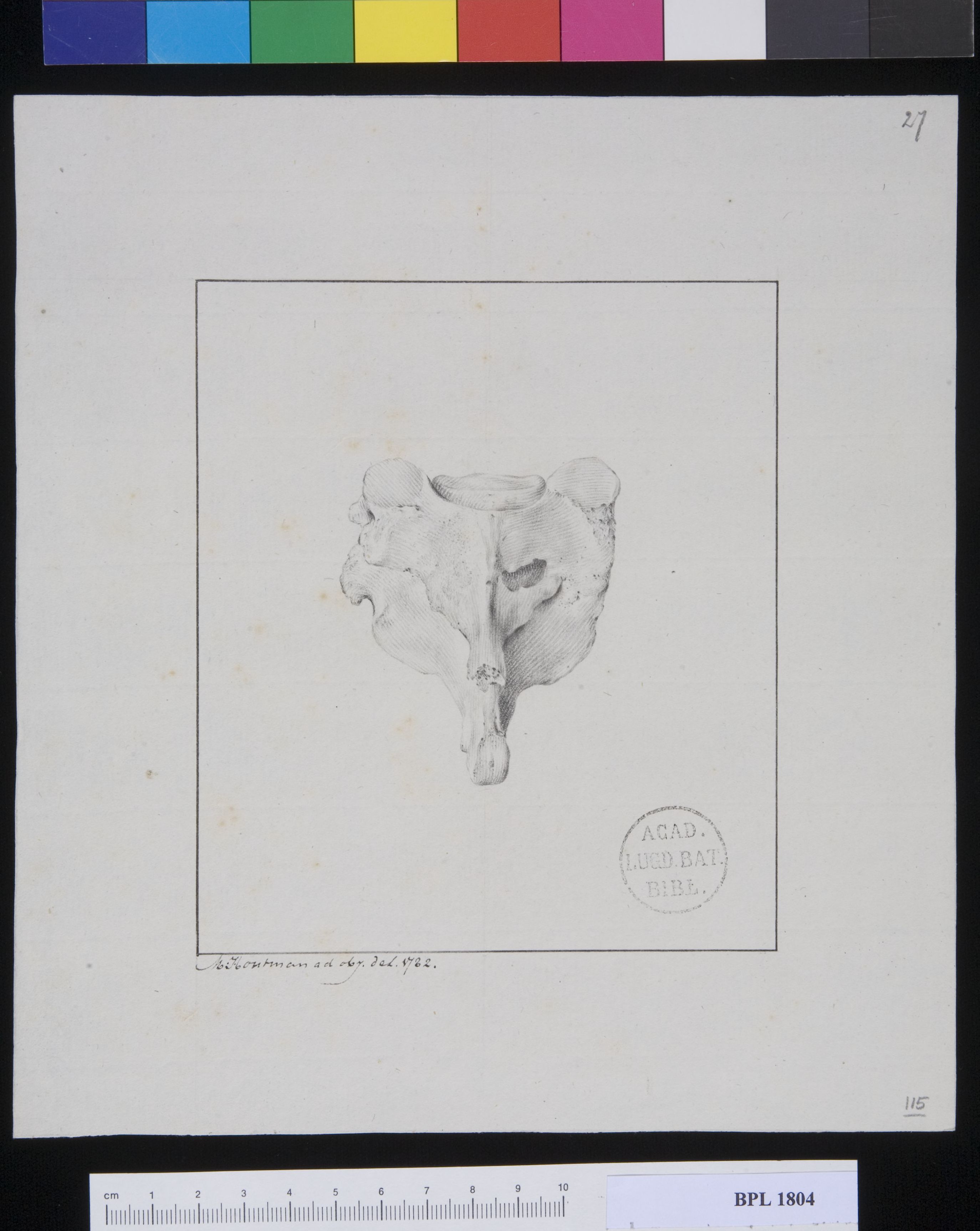 Pathology, fractures
