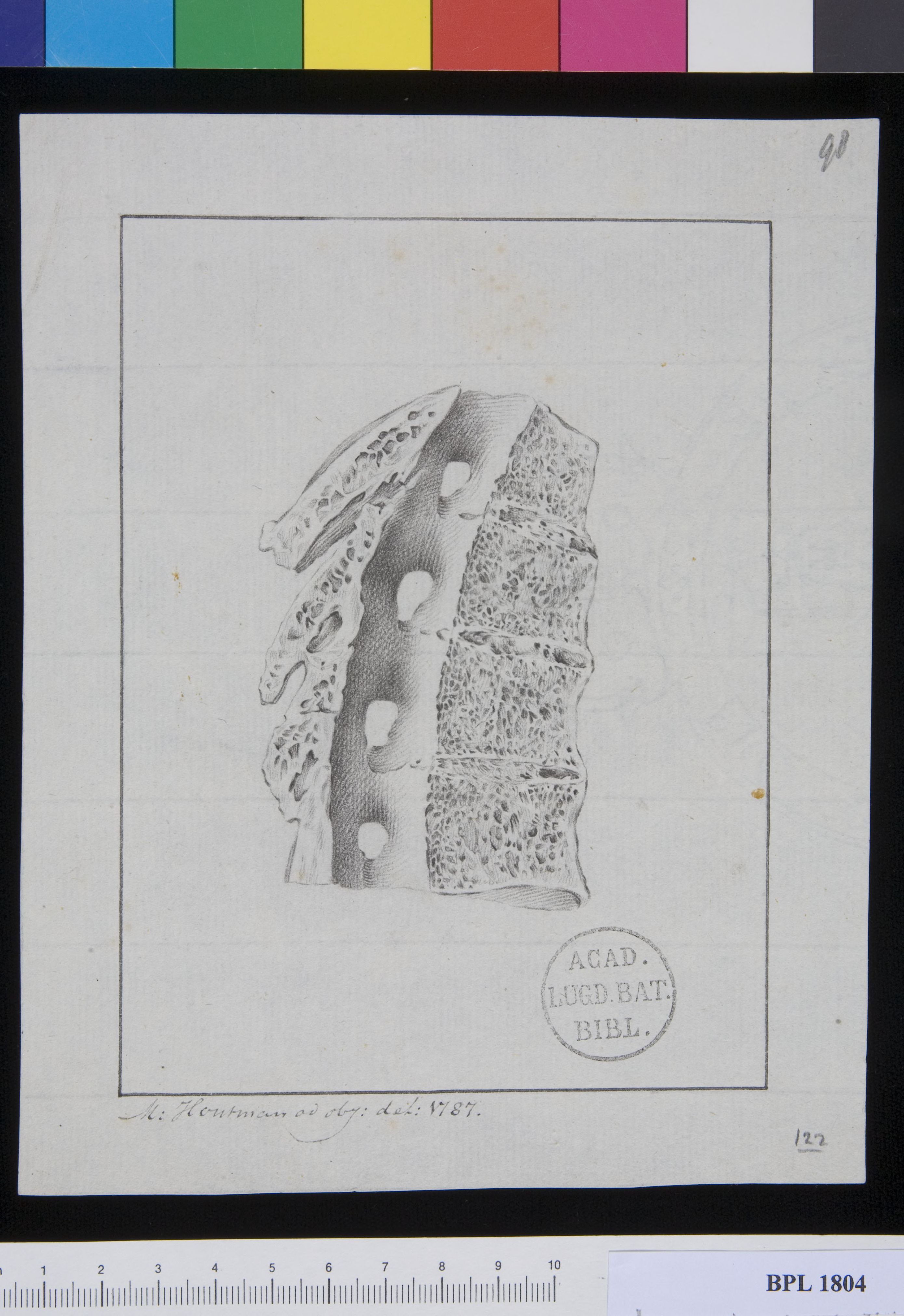Pathology, fractures (Spine, cervical vertebrae)