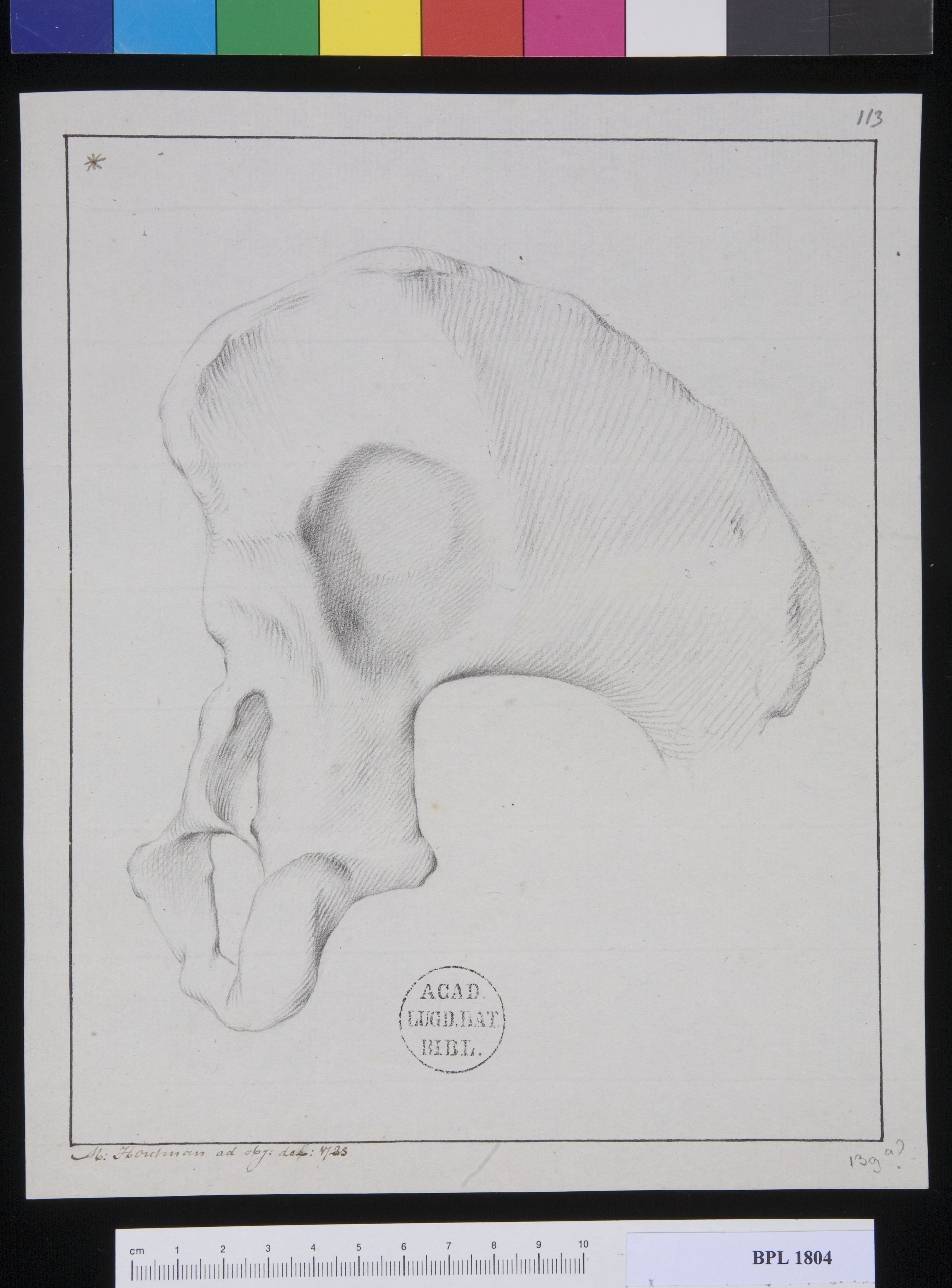 Pathology, fractures (Pelvis)