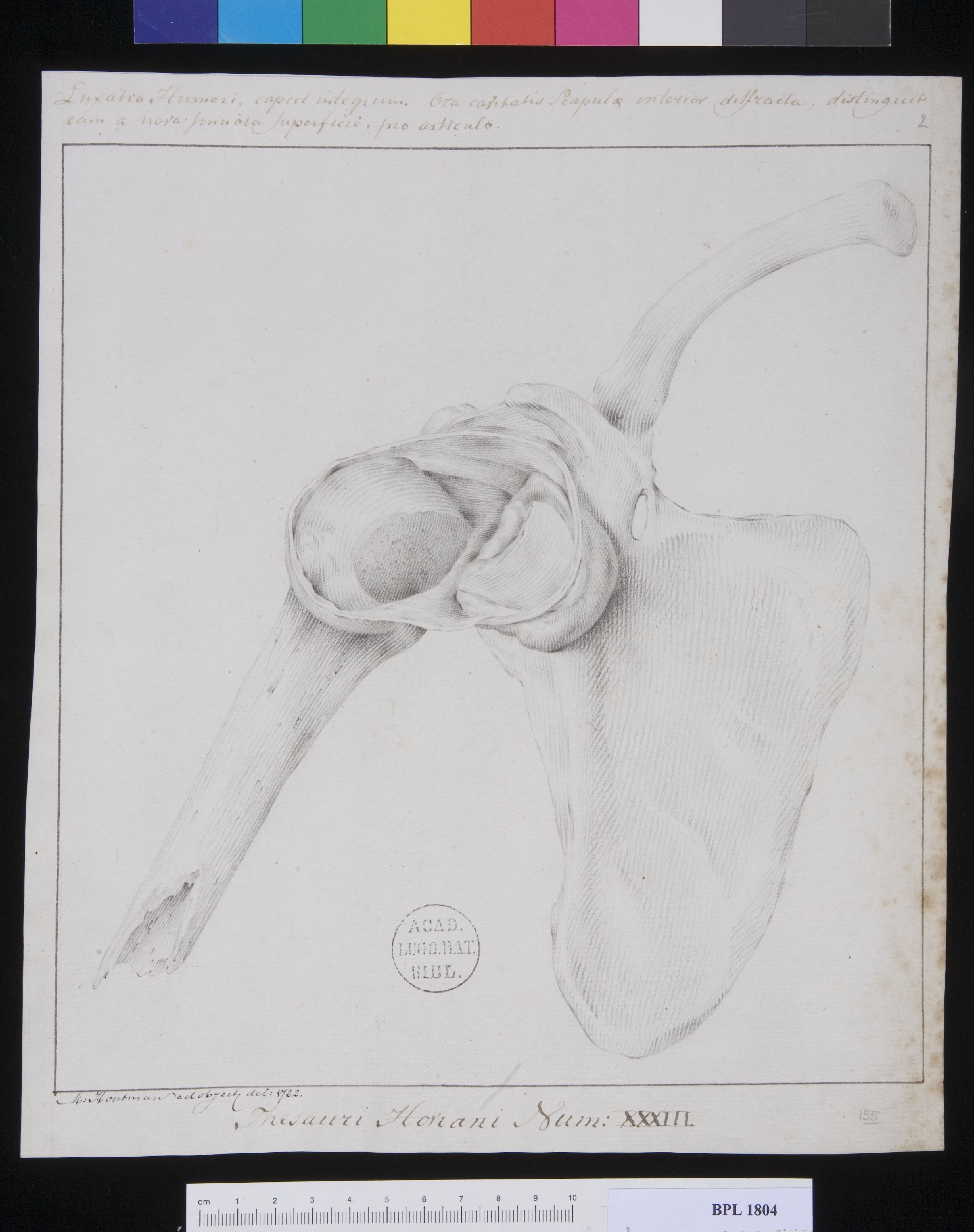 Pathology, fractures (Shoulder)