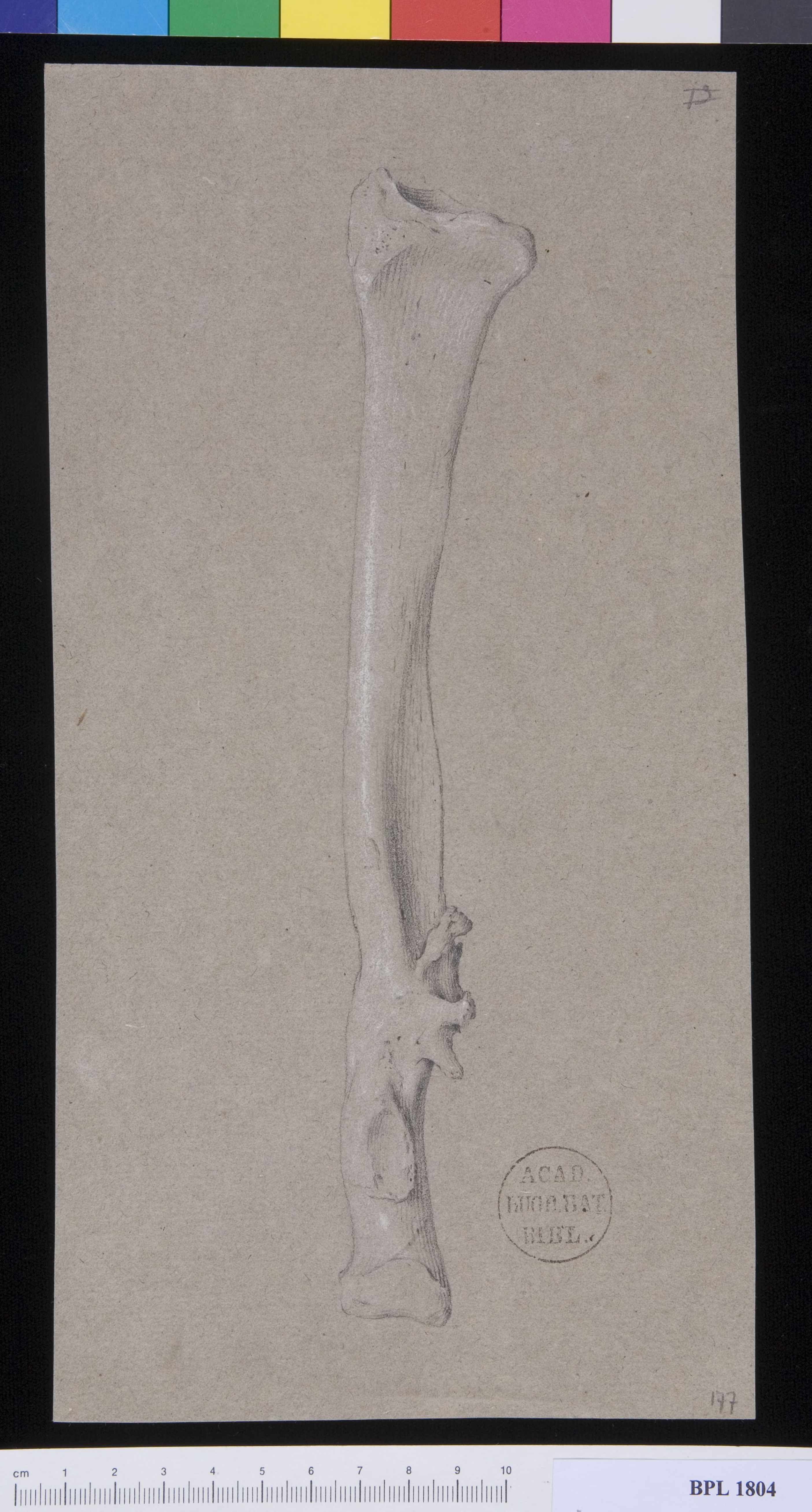 Pathology, fractures (Forearm)