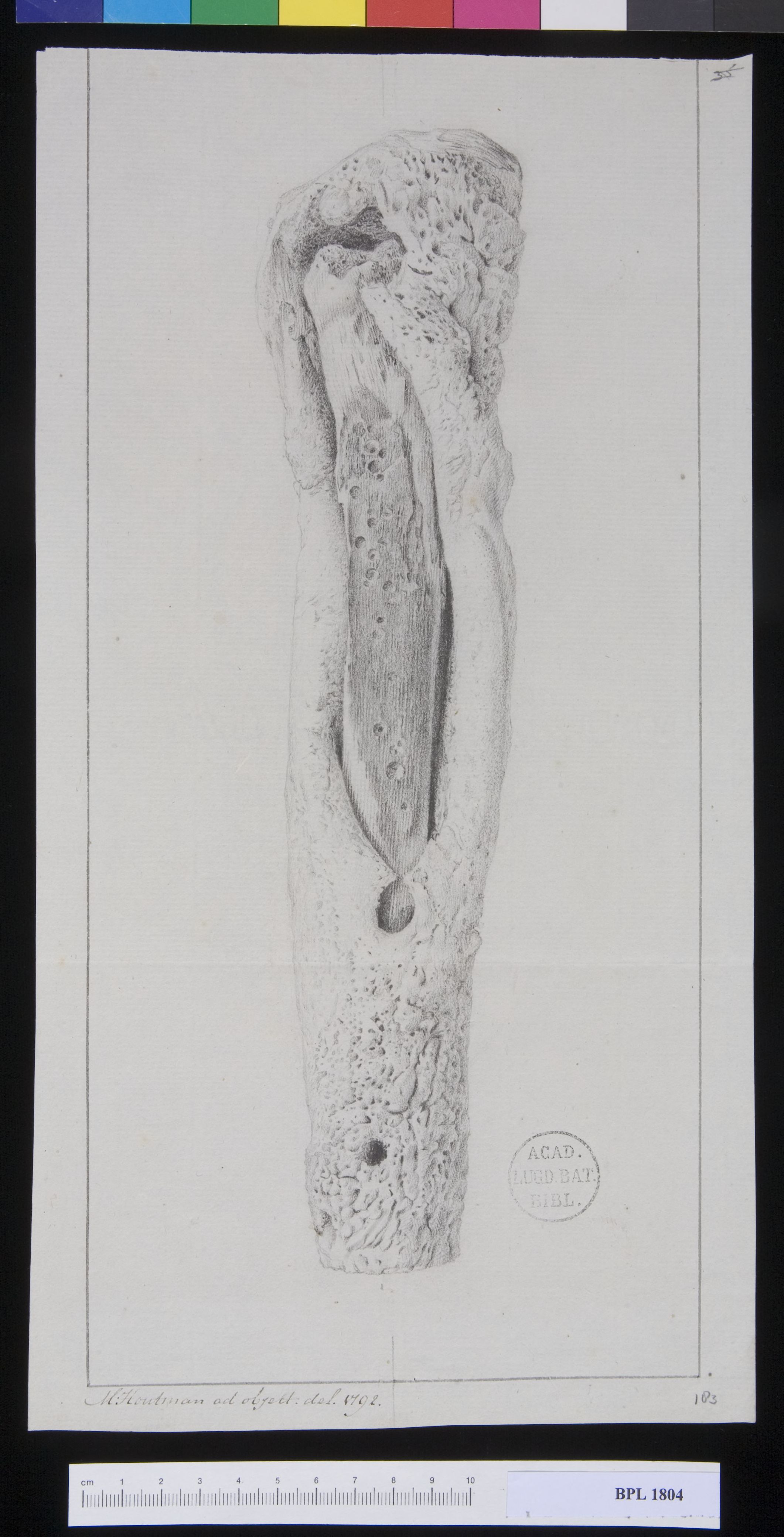Pathology, fractures (Lower leg)