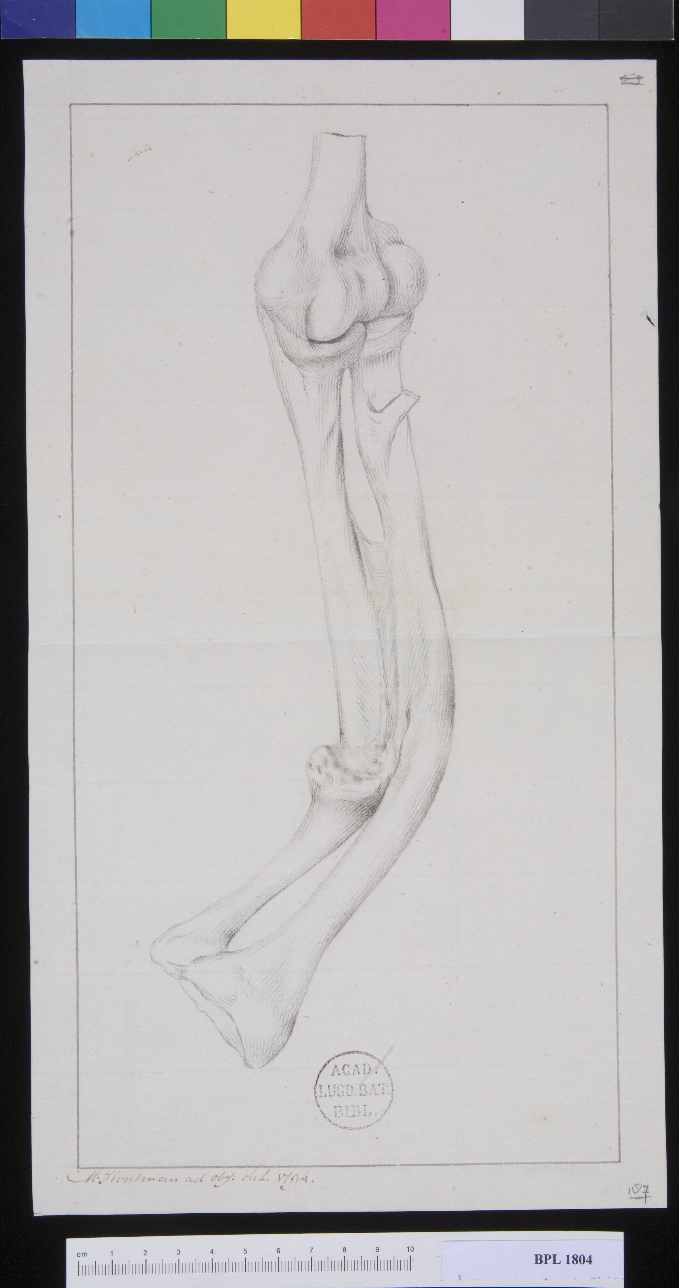 Pathology, fractures (Forearm)