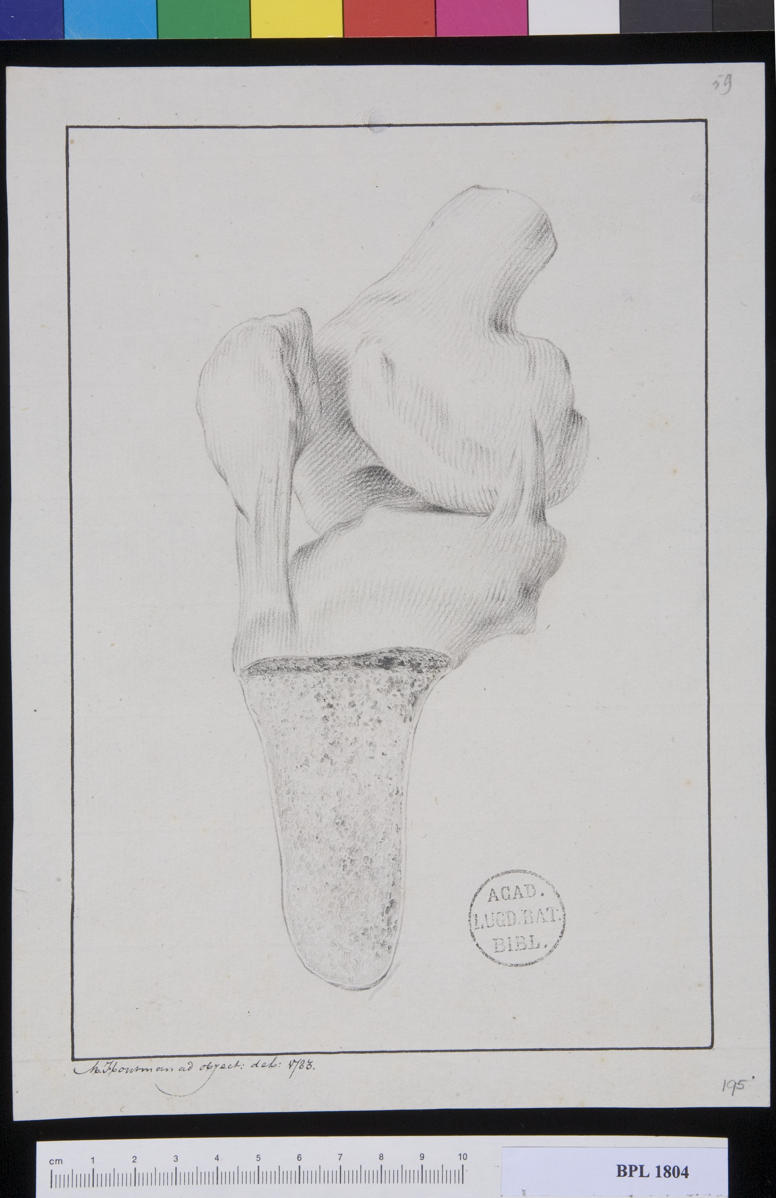 Pathology, fractures (Knee)