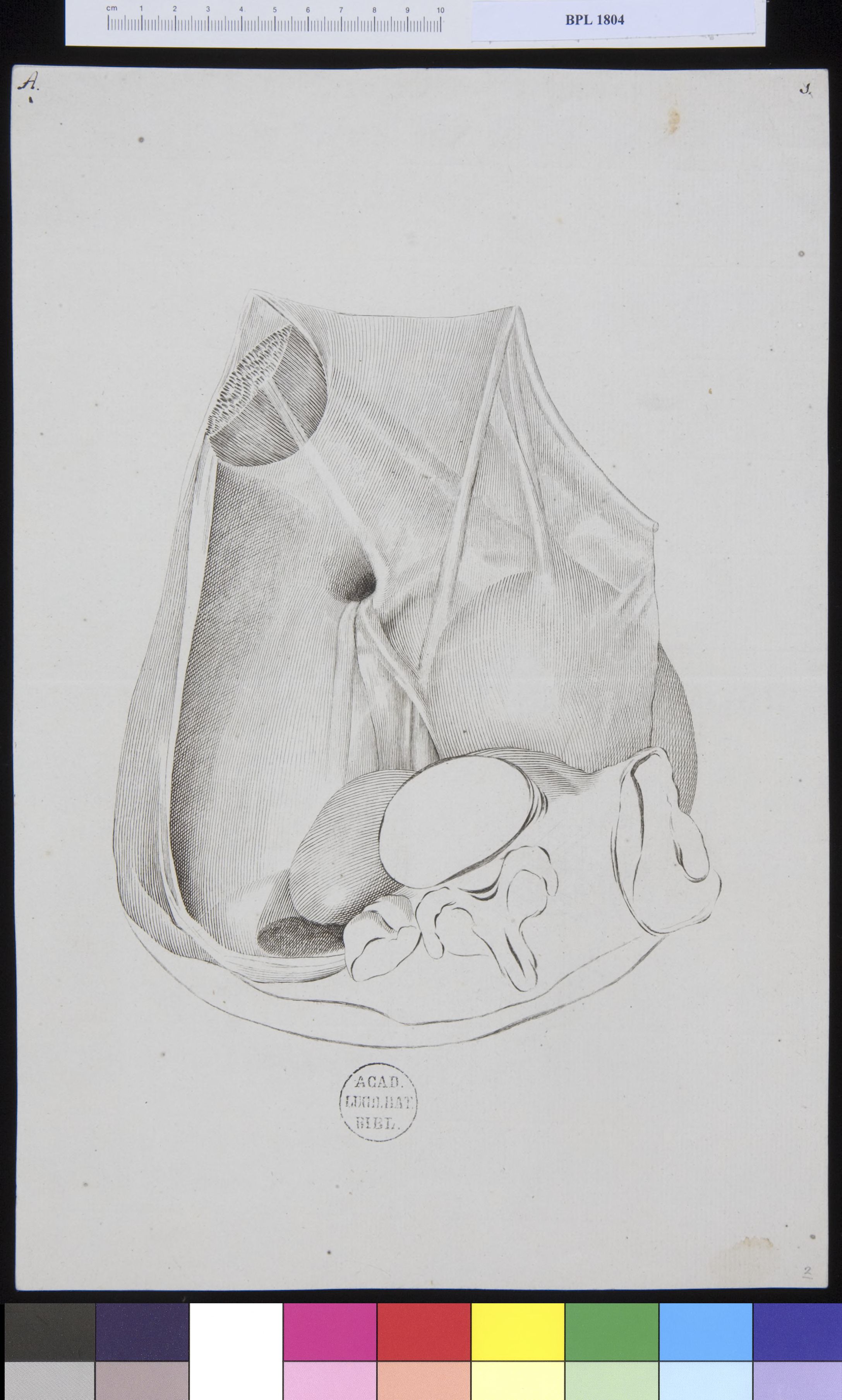 Pathology, fractures