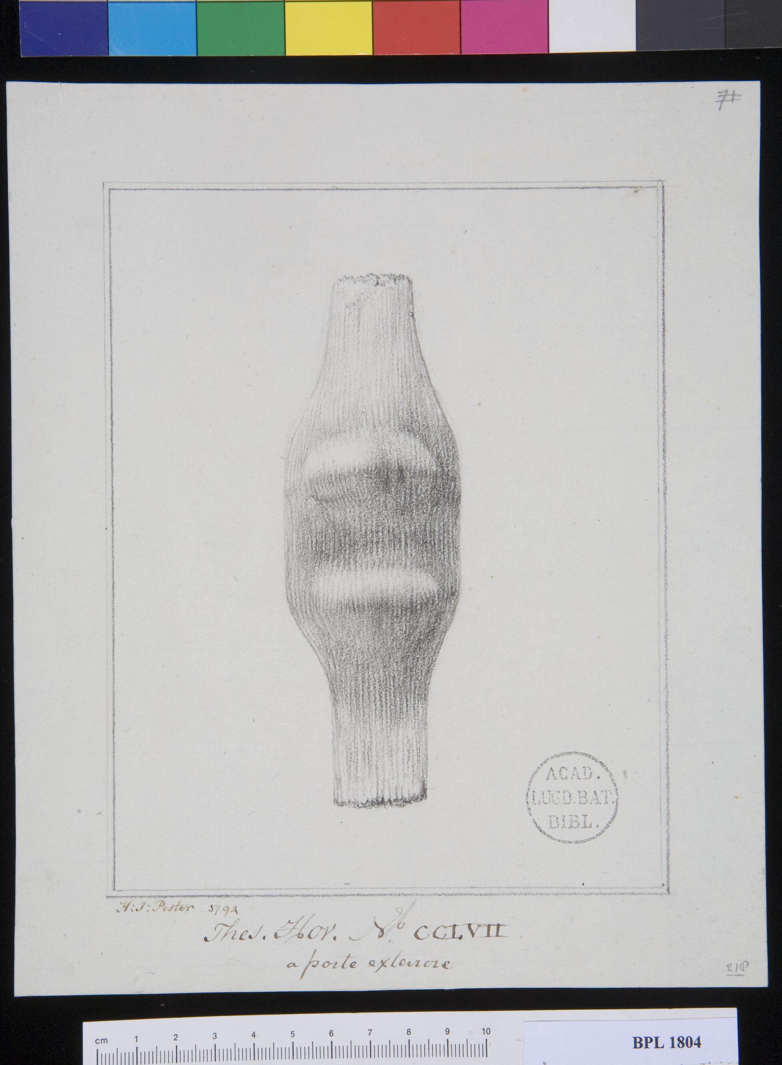Pathology, fractures (Patella)