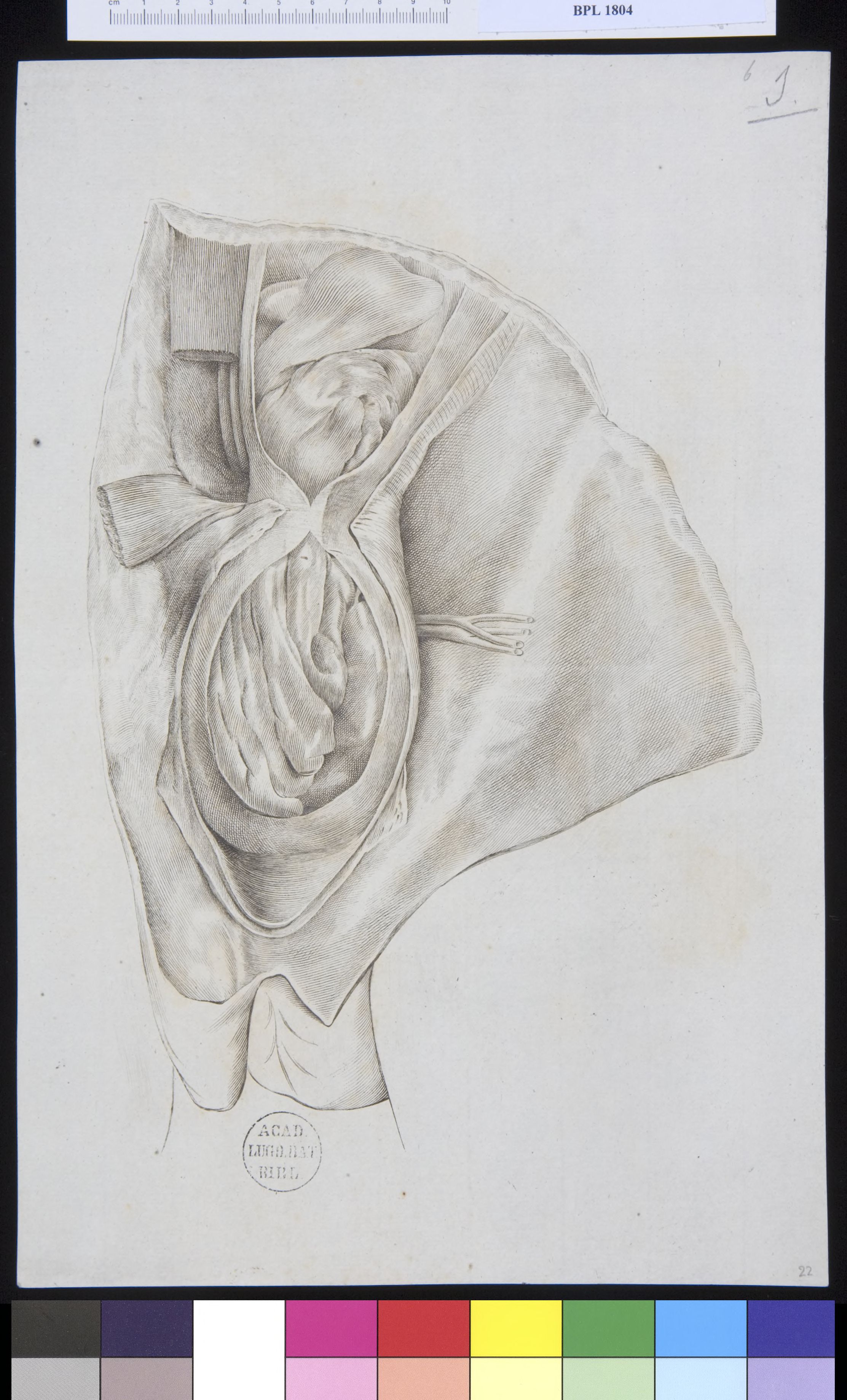 Pathology, fractures (testicles)