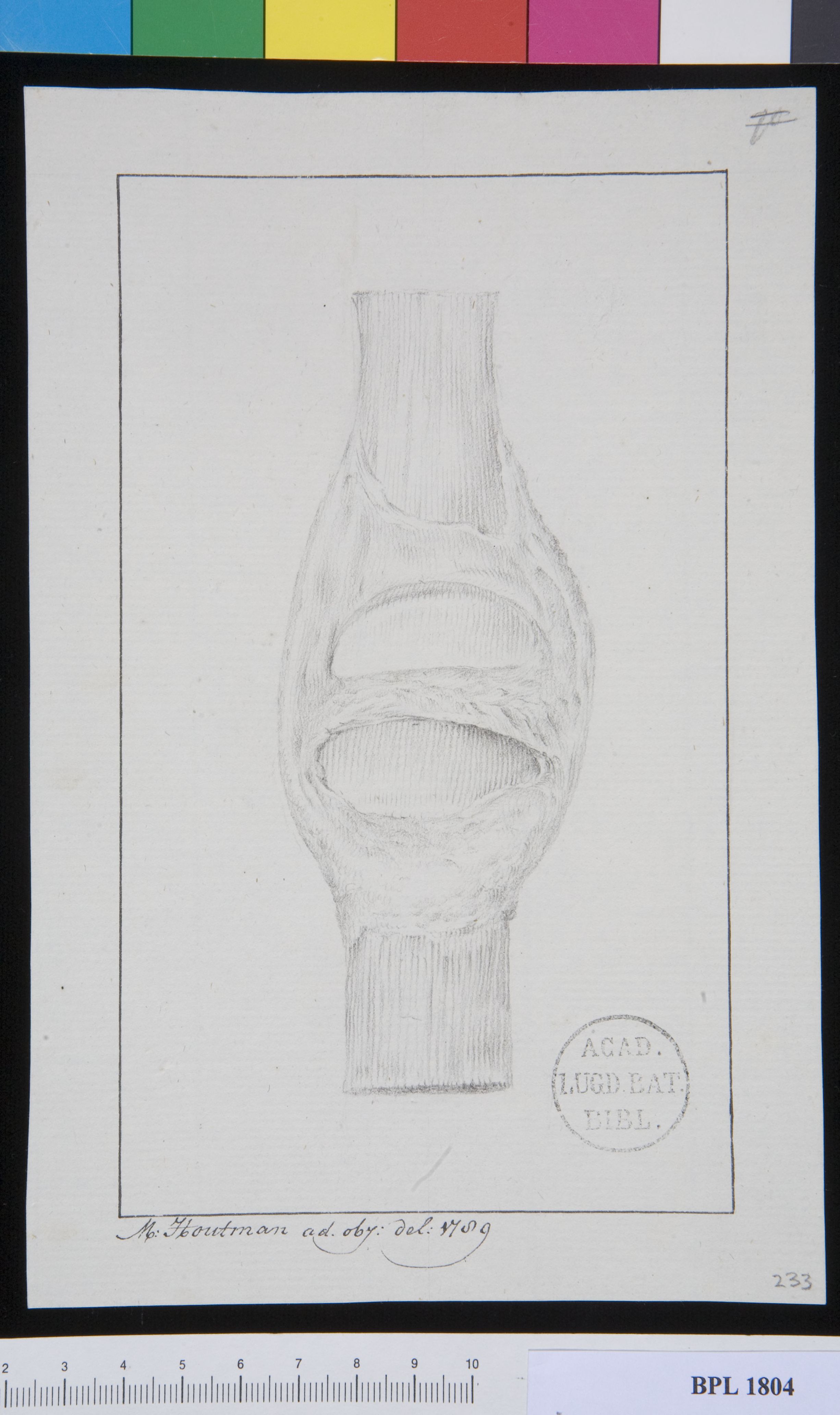 Pathology, fractures (Patella)