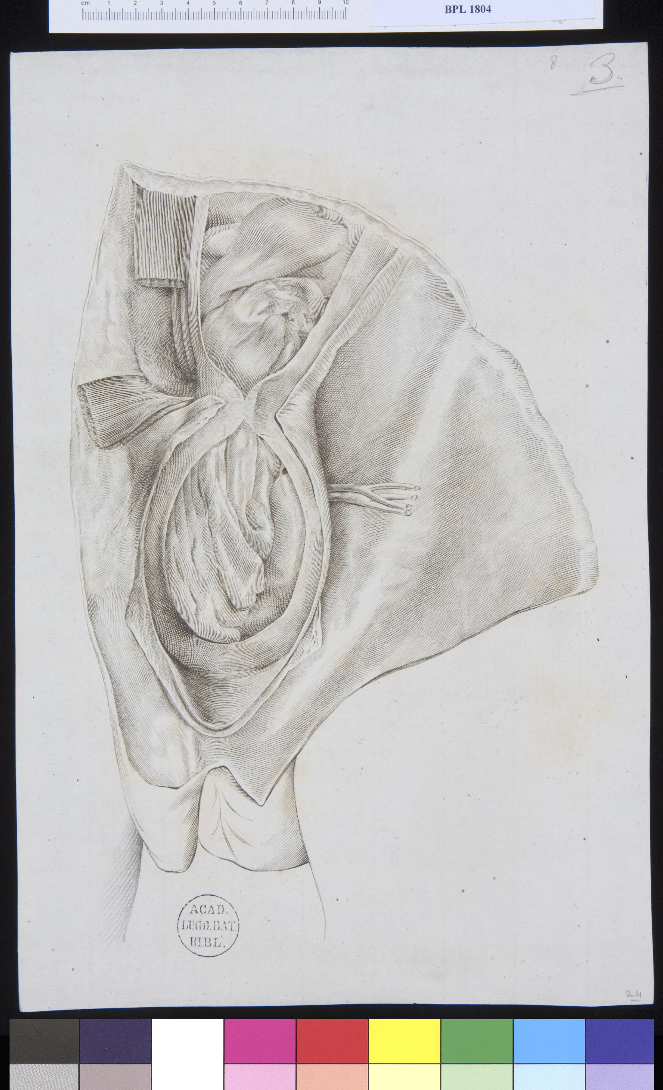 Pathology, fractures (testicles)