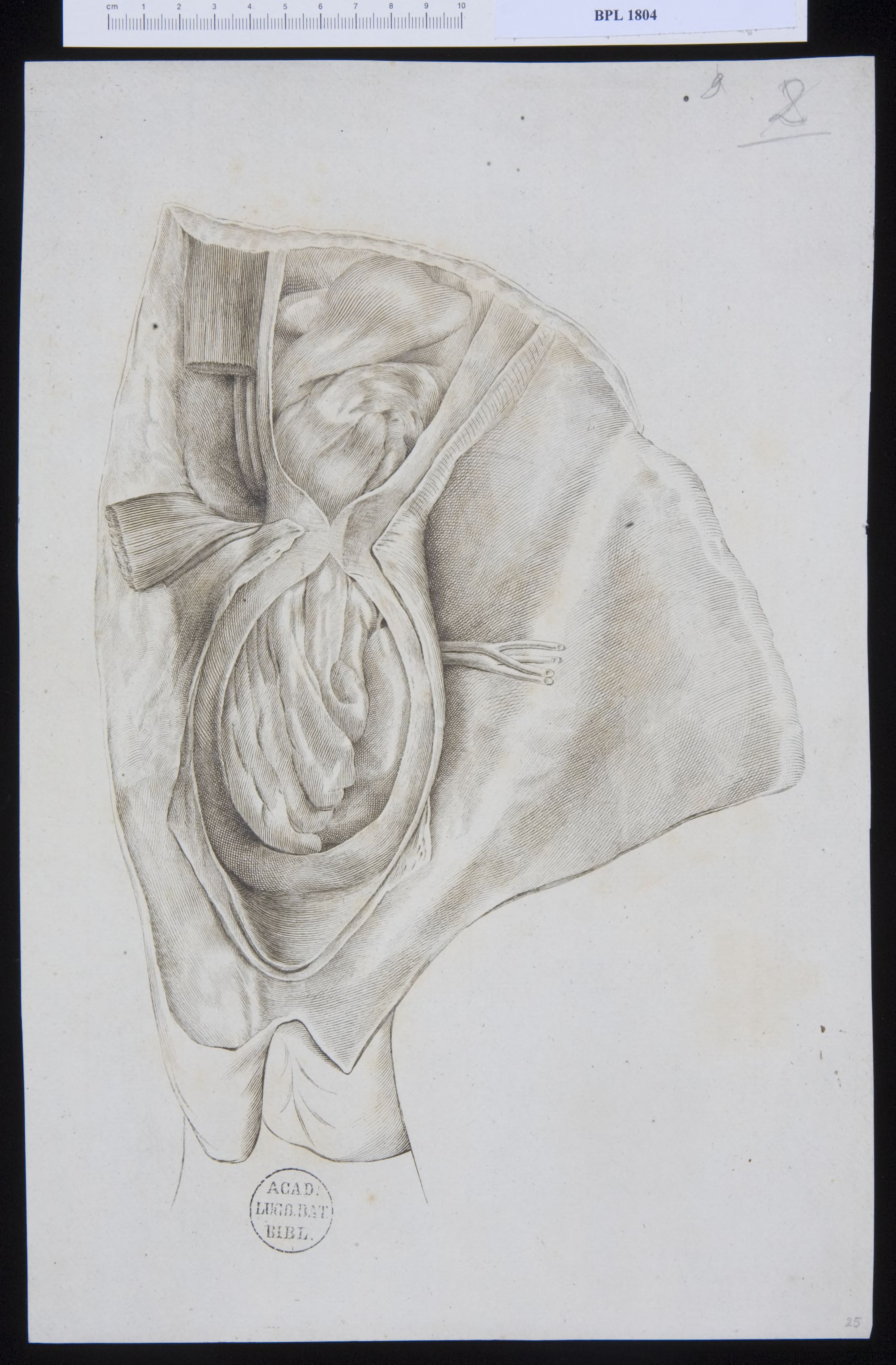 Pathology, fractures (testicles)