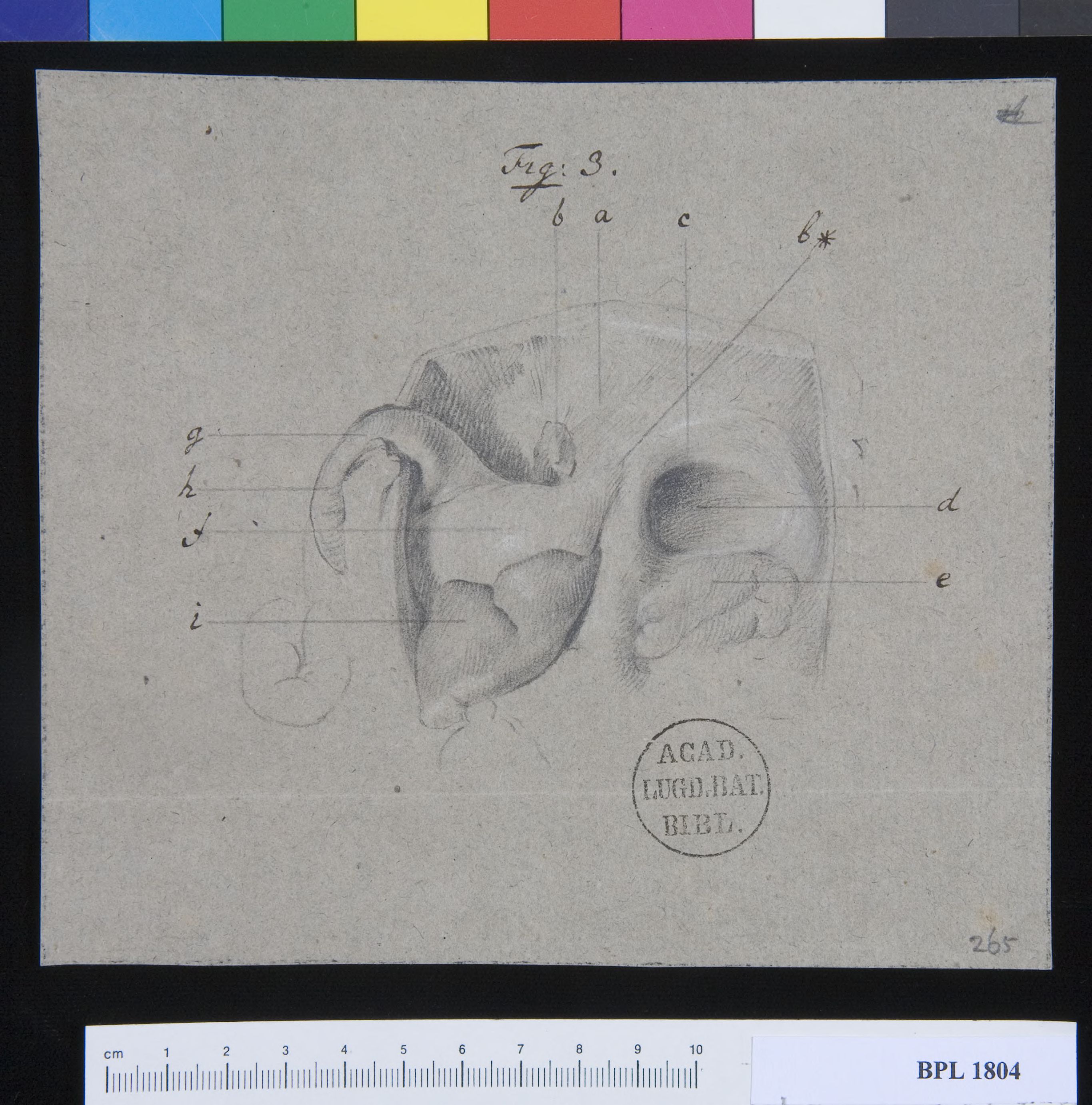 Pathology, fractures