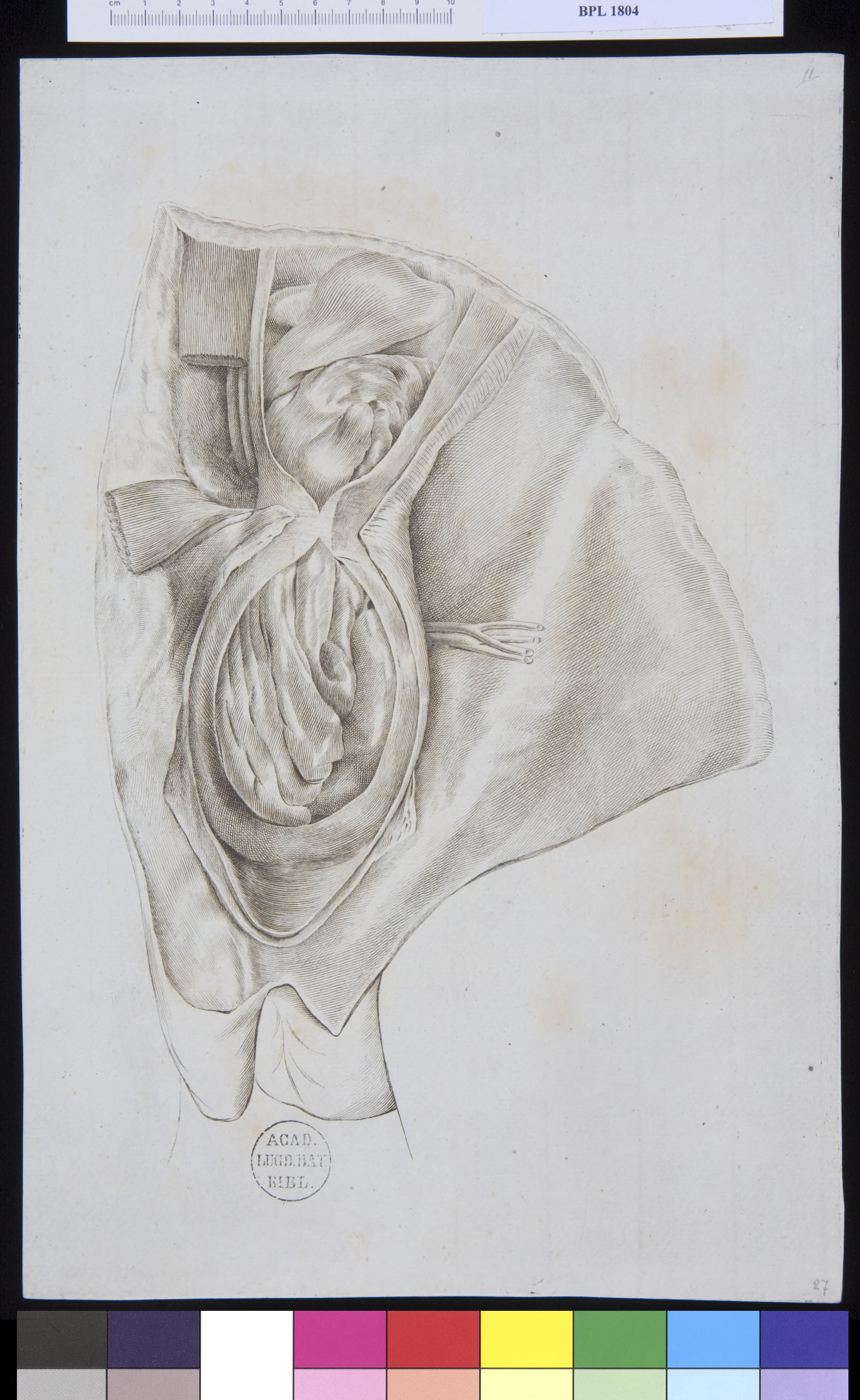Pathology, fractures (testicles)