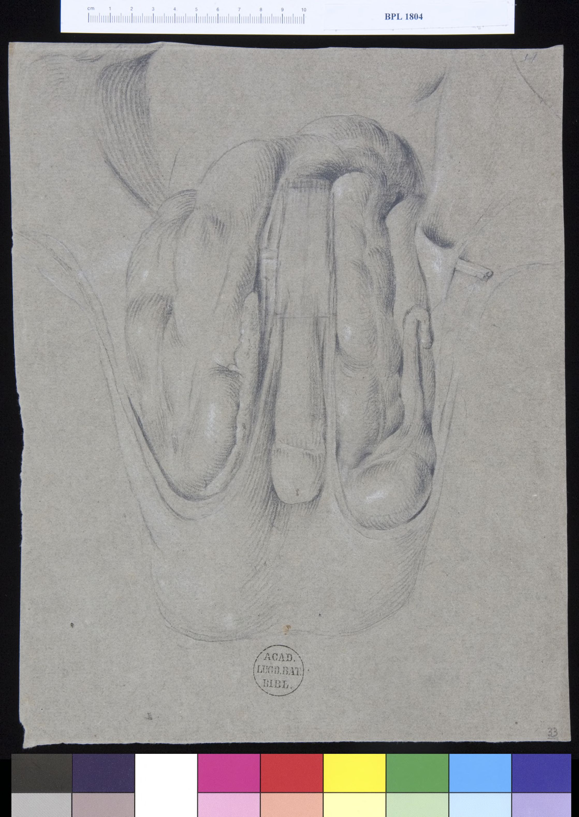 Pathology, fractures (testicles)