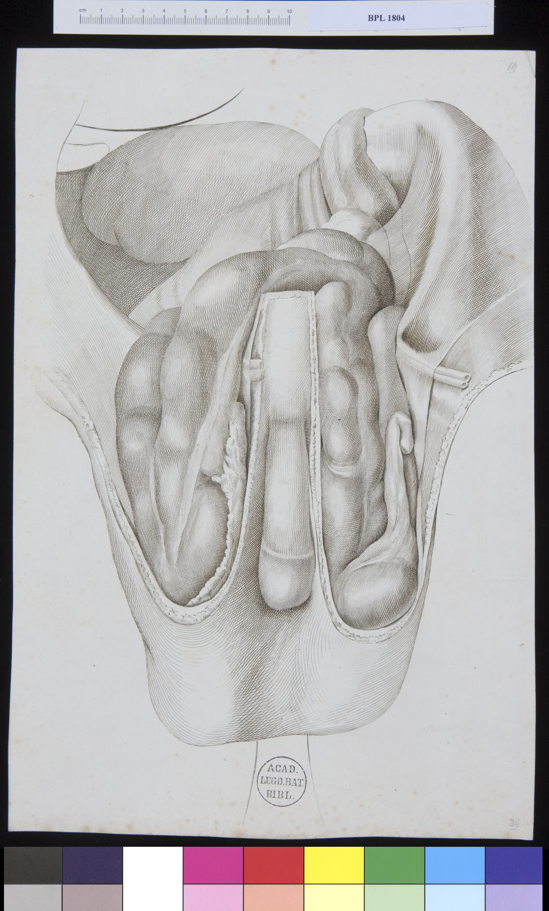 Pathology, fractures (testicles)