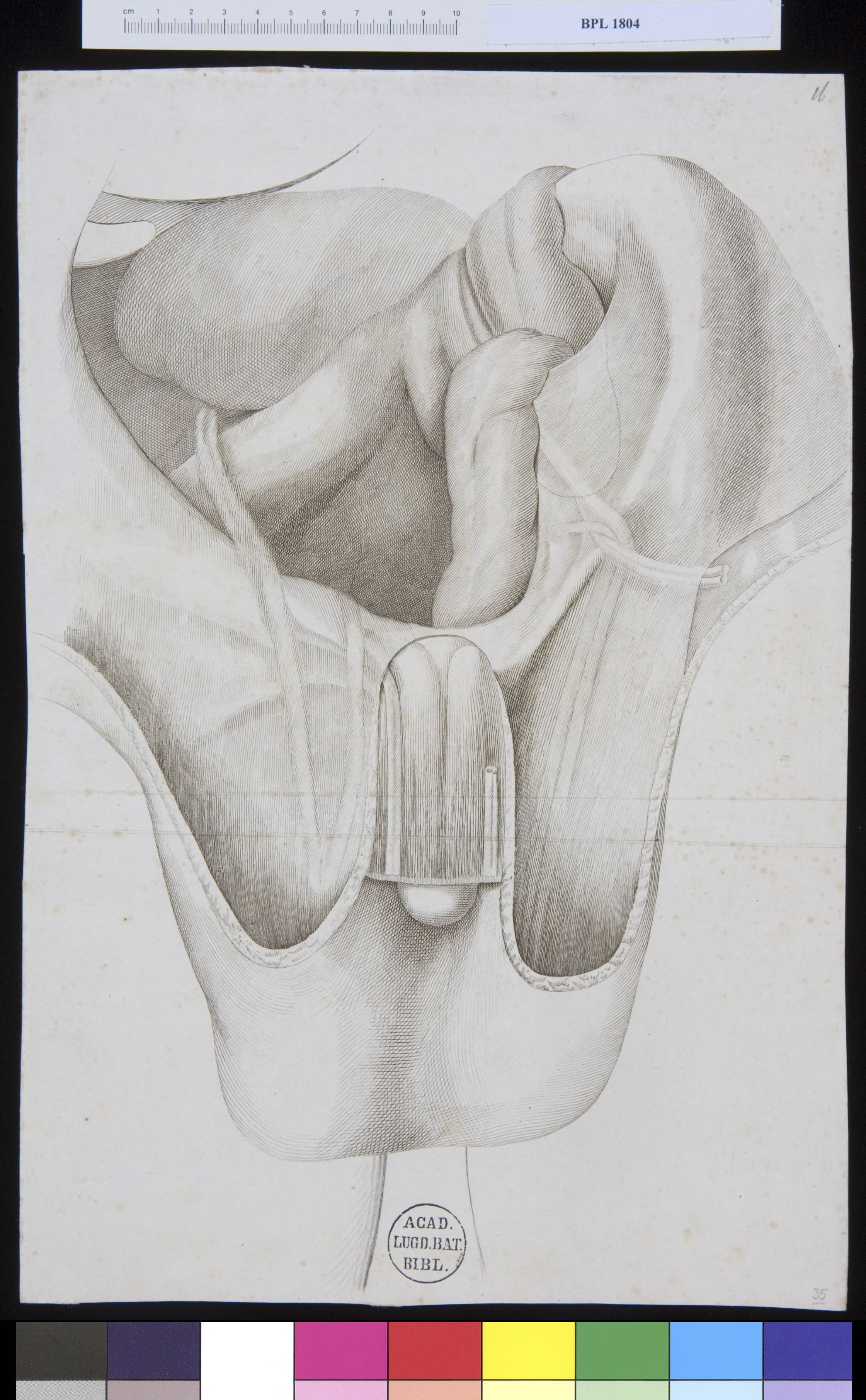 Pathology, fractures (testicles)