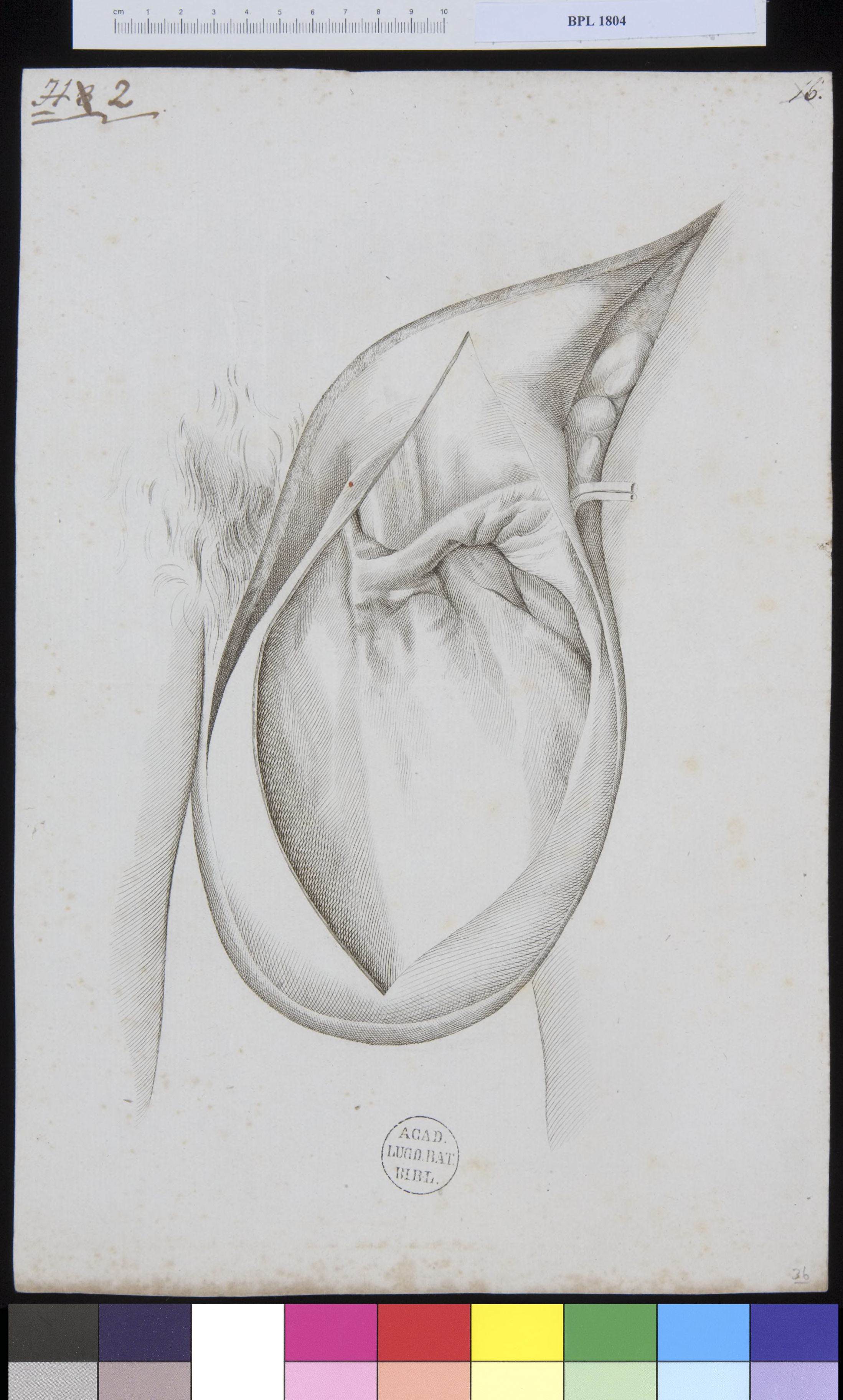 Pathology, fractures (testicles)