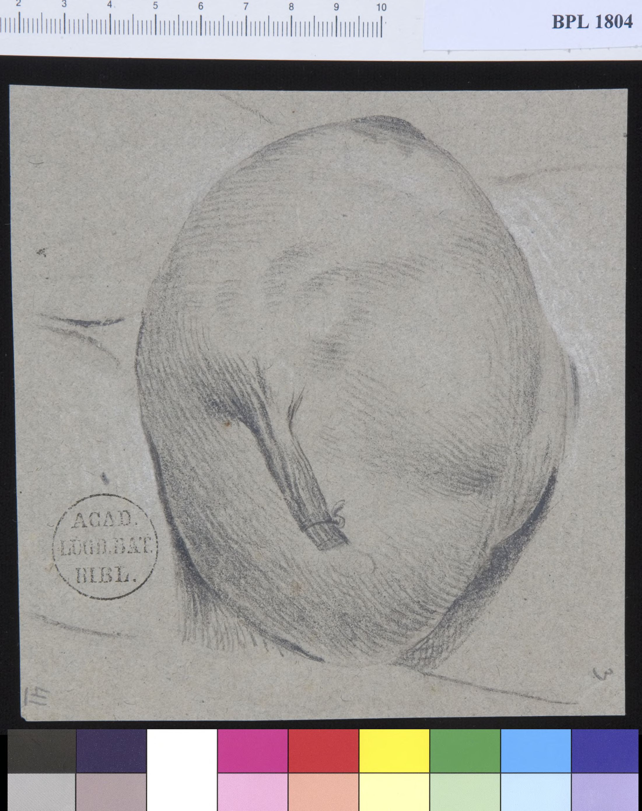 Pathology, fractures