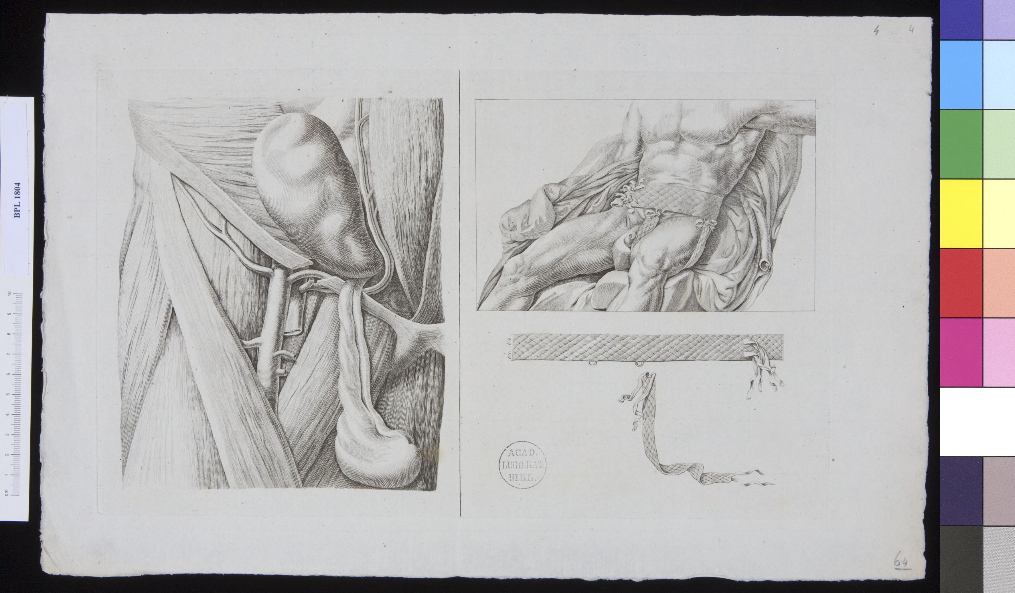 Pathology, fractures