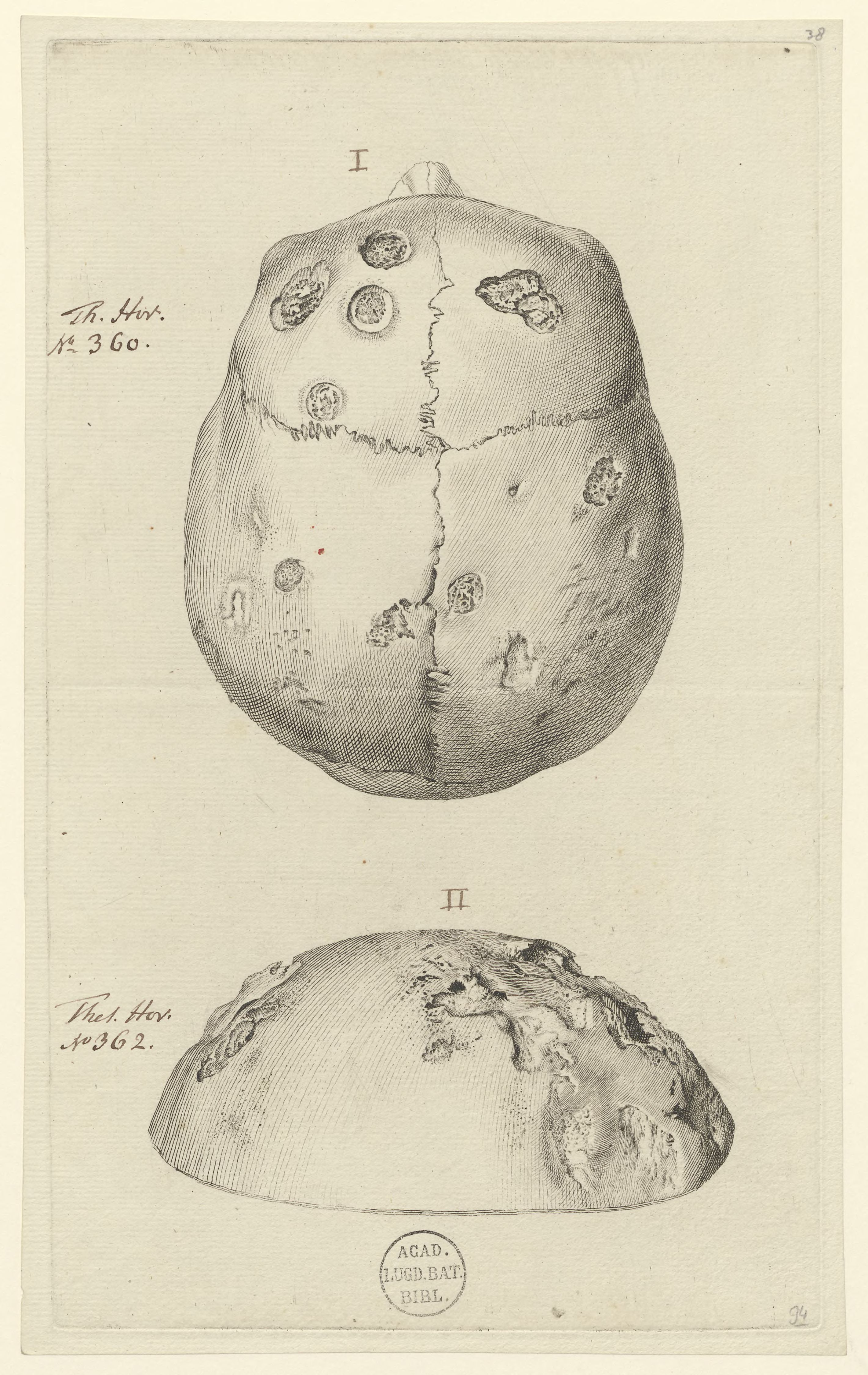 Skull: Pathology, fractures