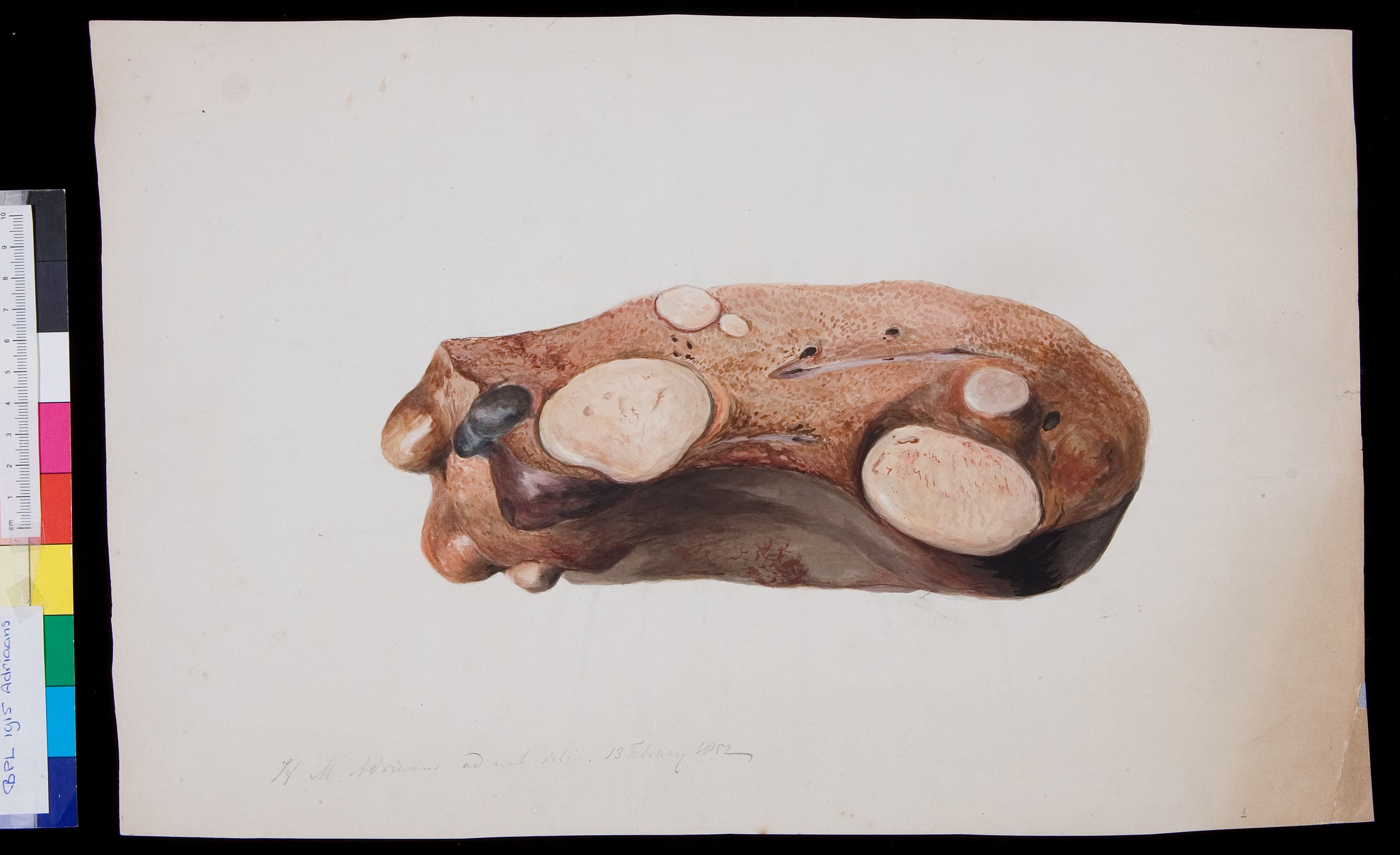 Liver