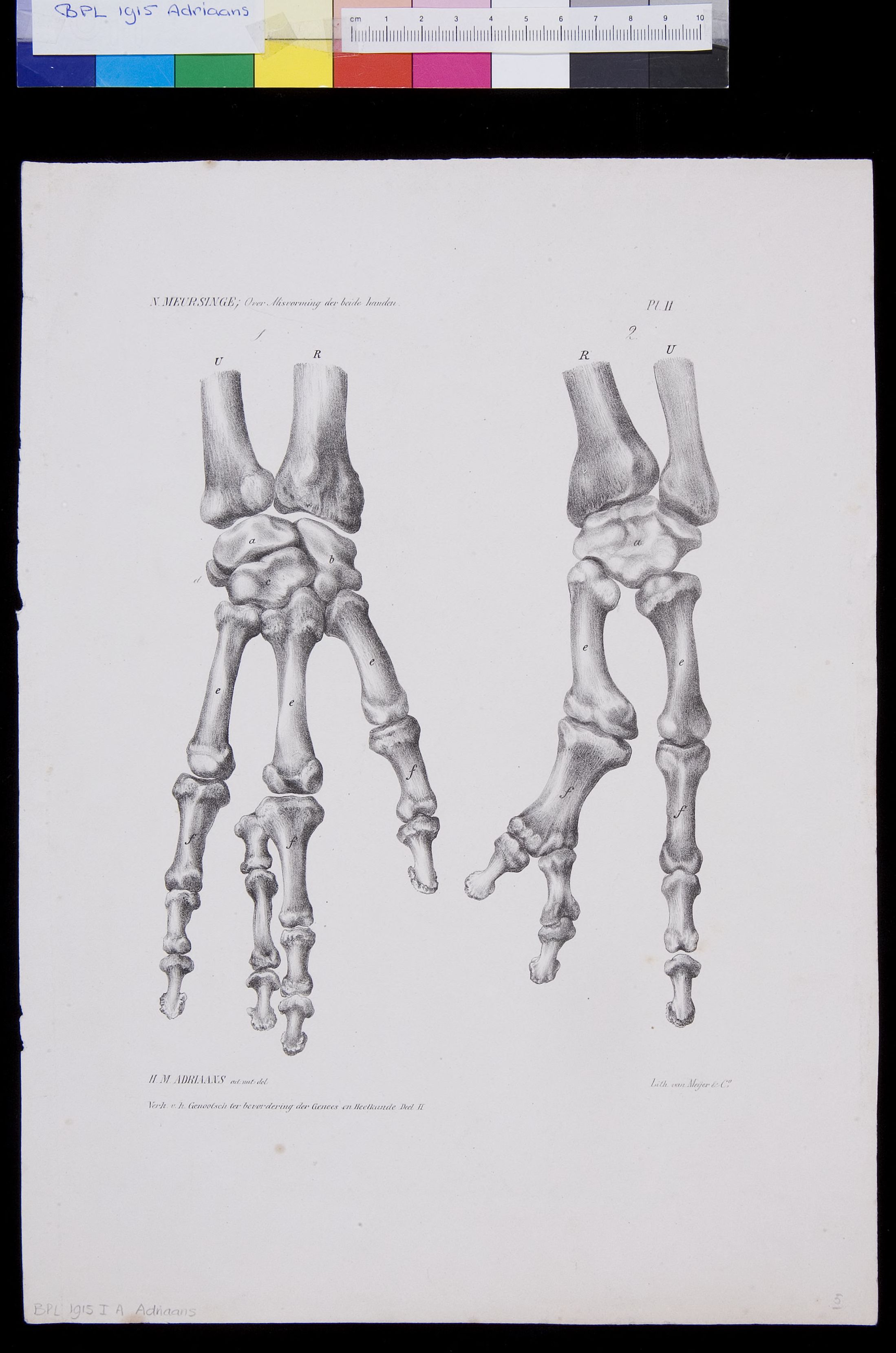 Bones of the hands