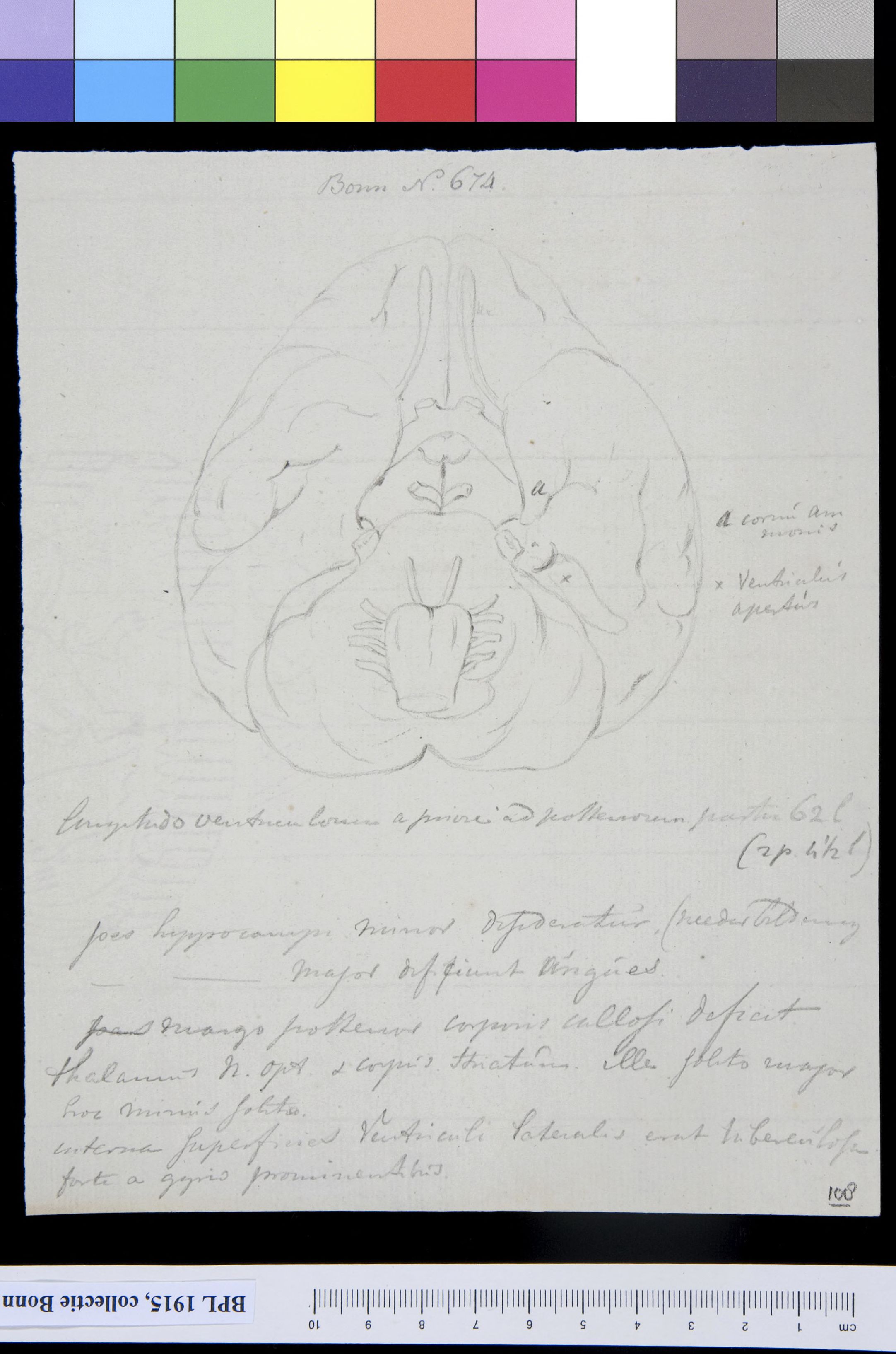 Brain