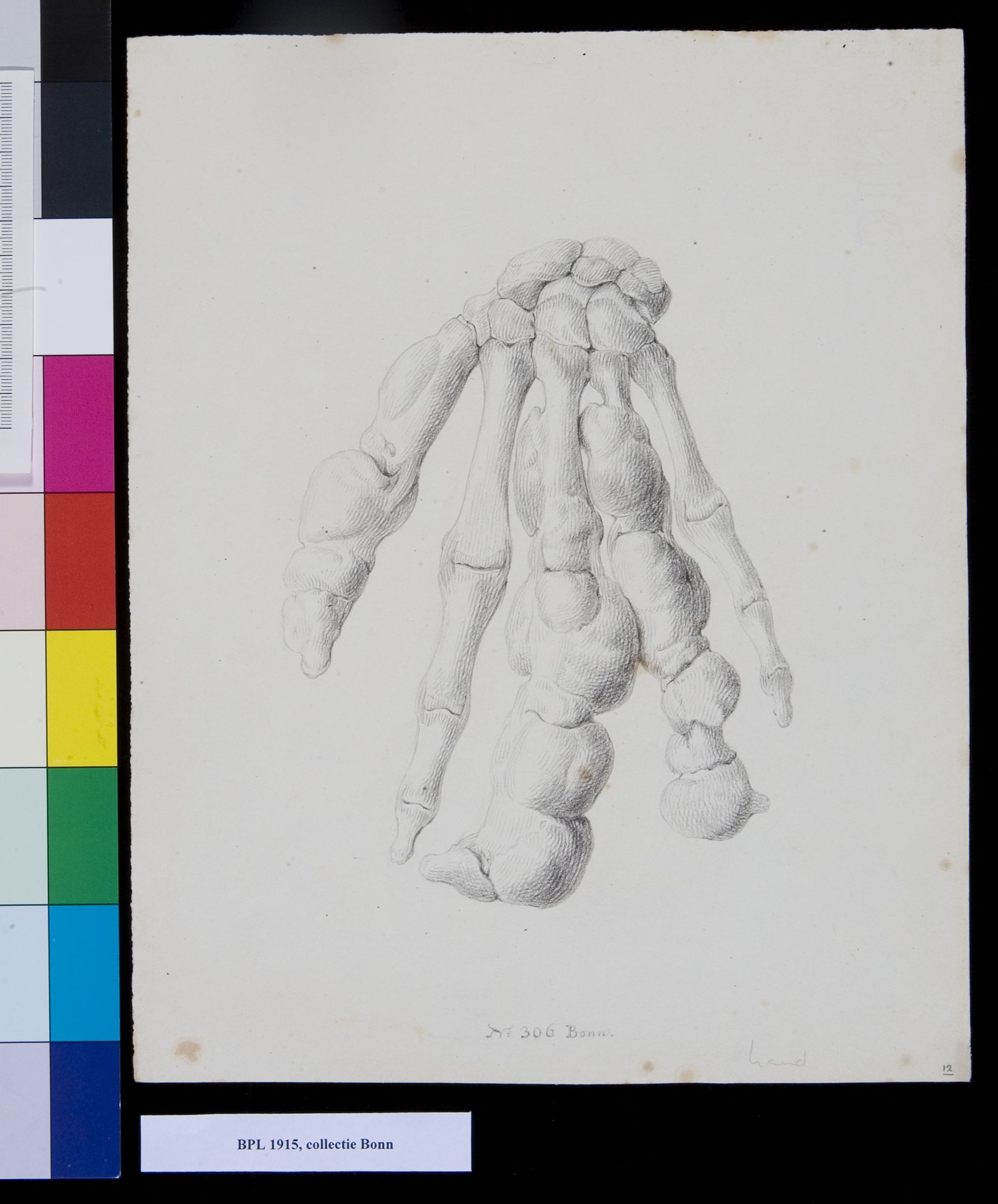 Bones of the hand
