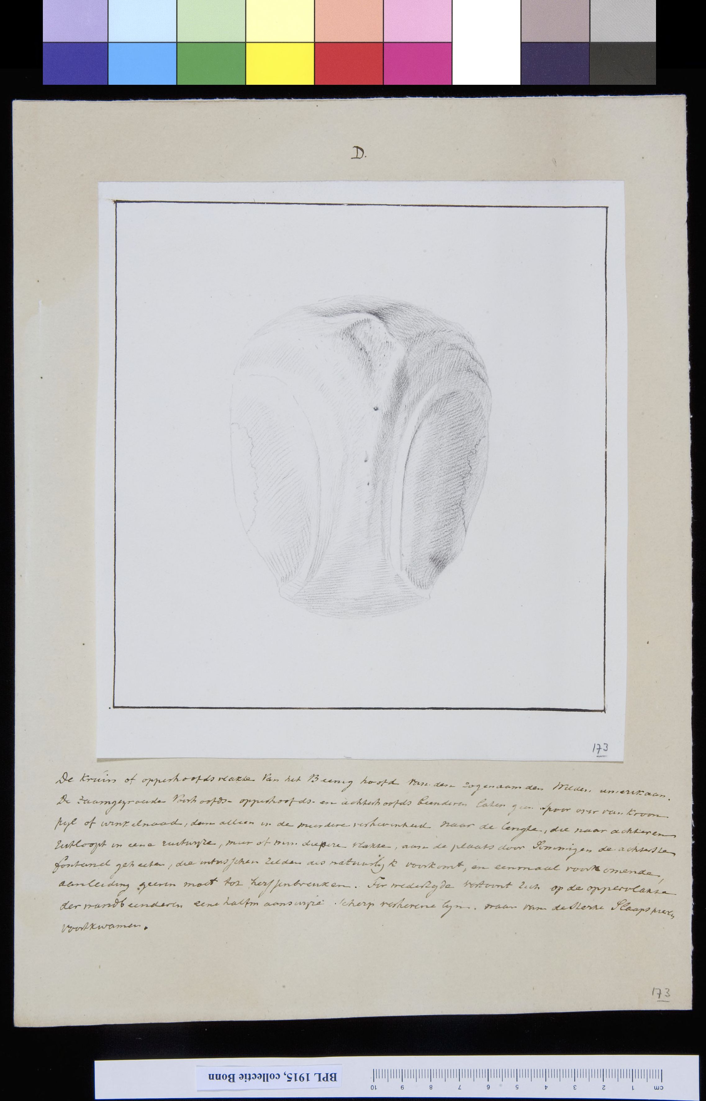 Skull, view from above
