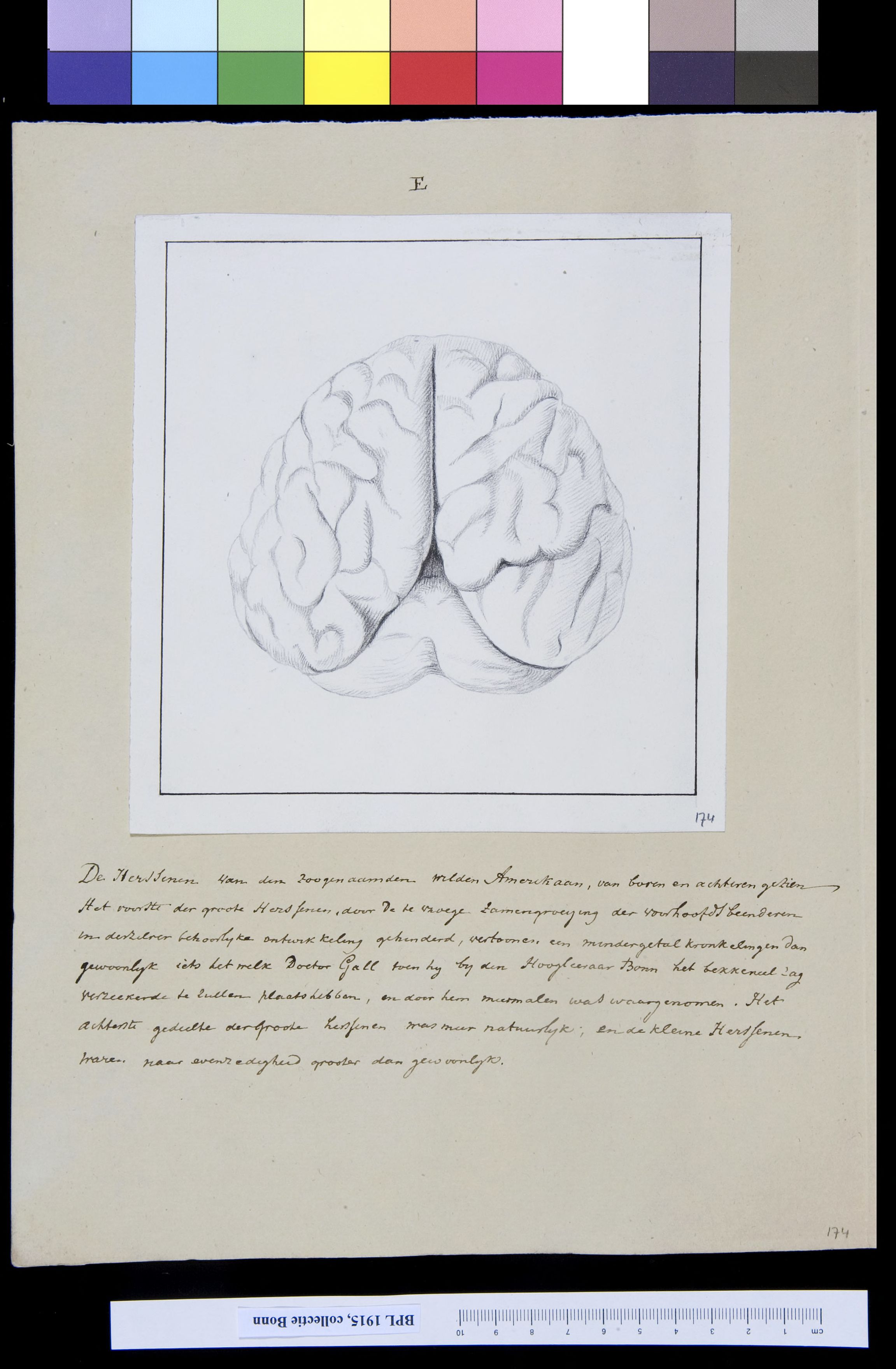 Brain