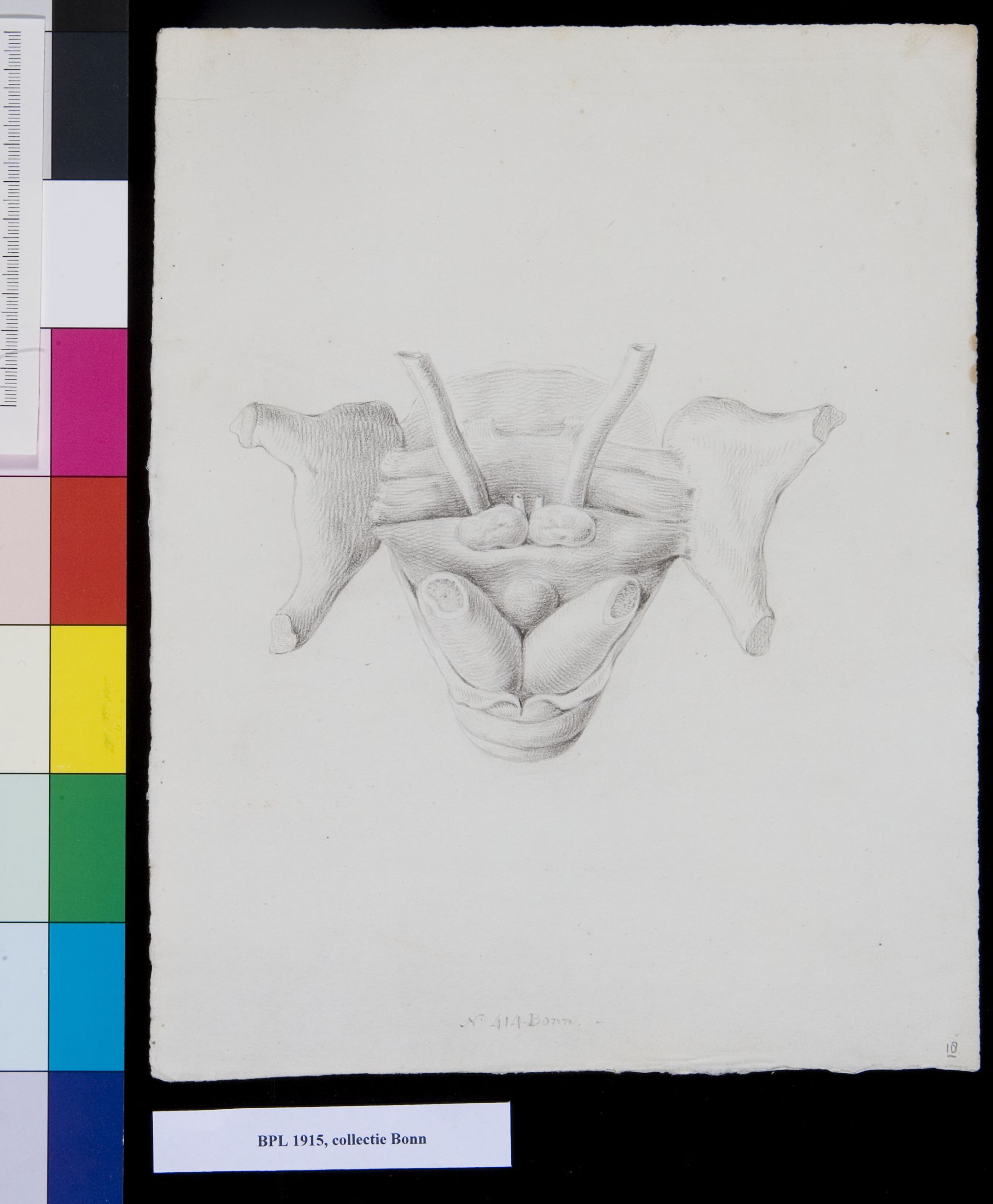 Unidentified bones