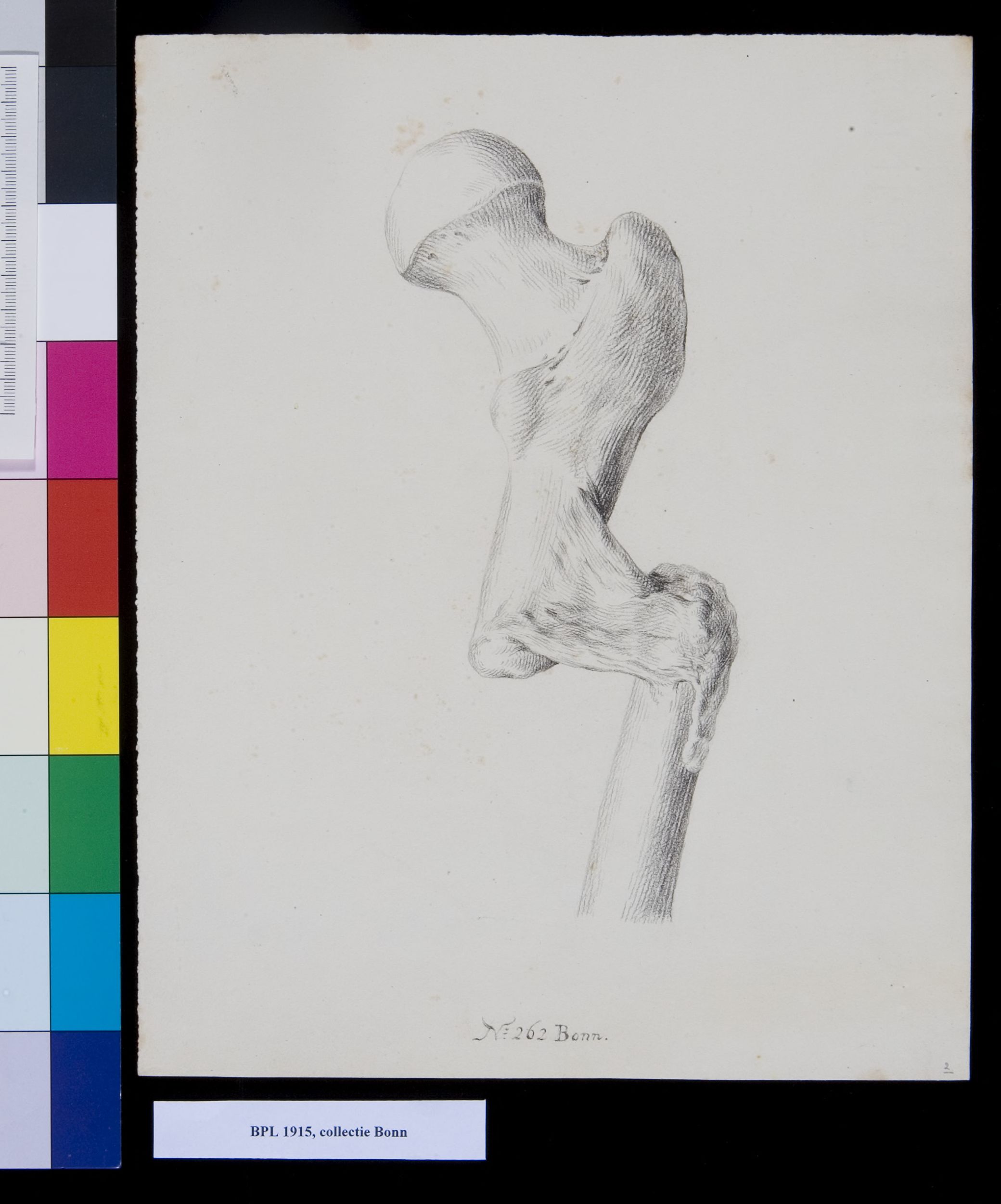 Bones of the upper leg (femur)