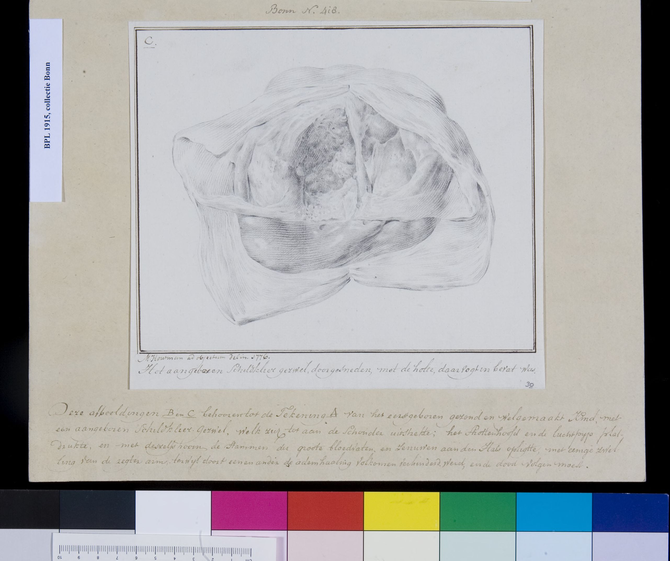 Thyroid, cross section
