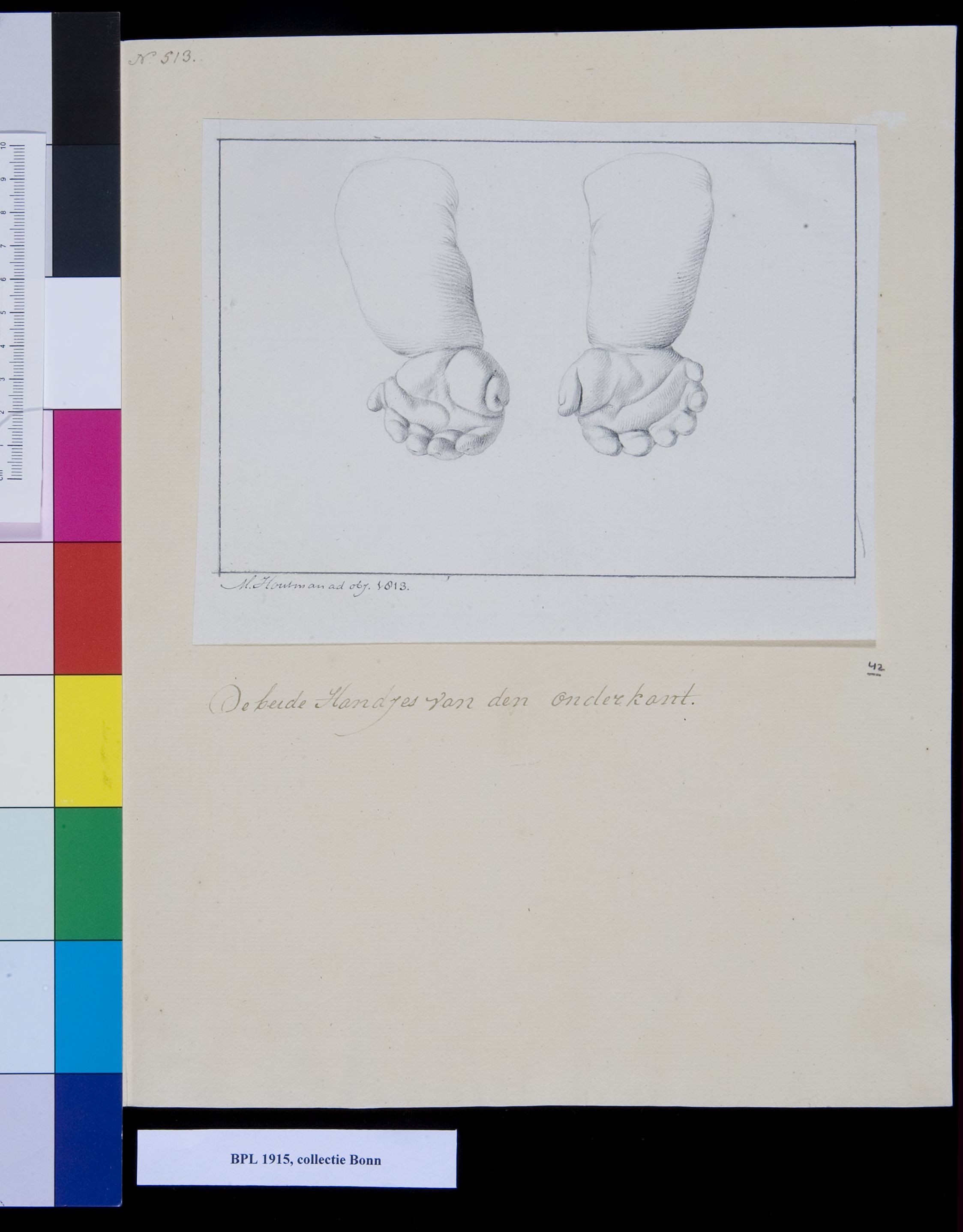 Children's hands with six fingers and a thumb
