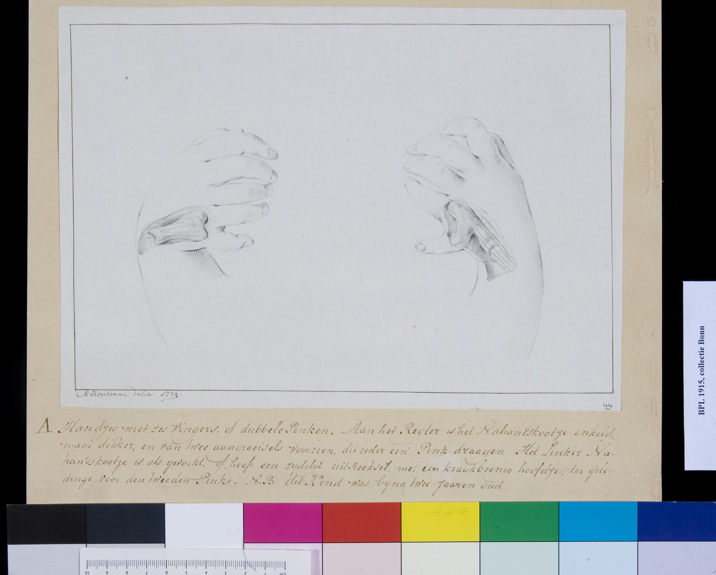 Children's hands with five fingers and a thumb