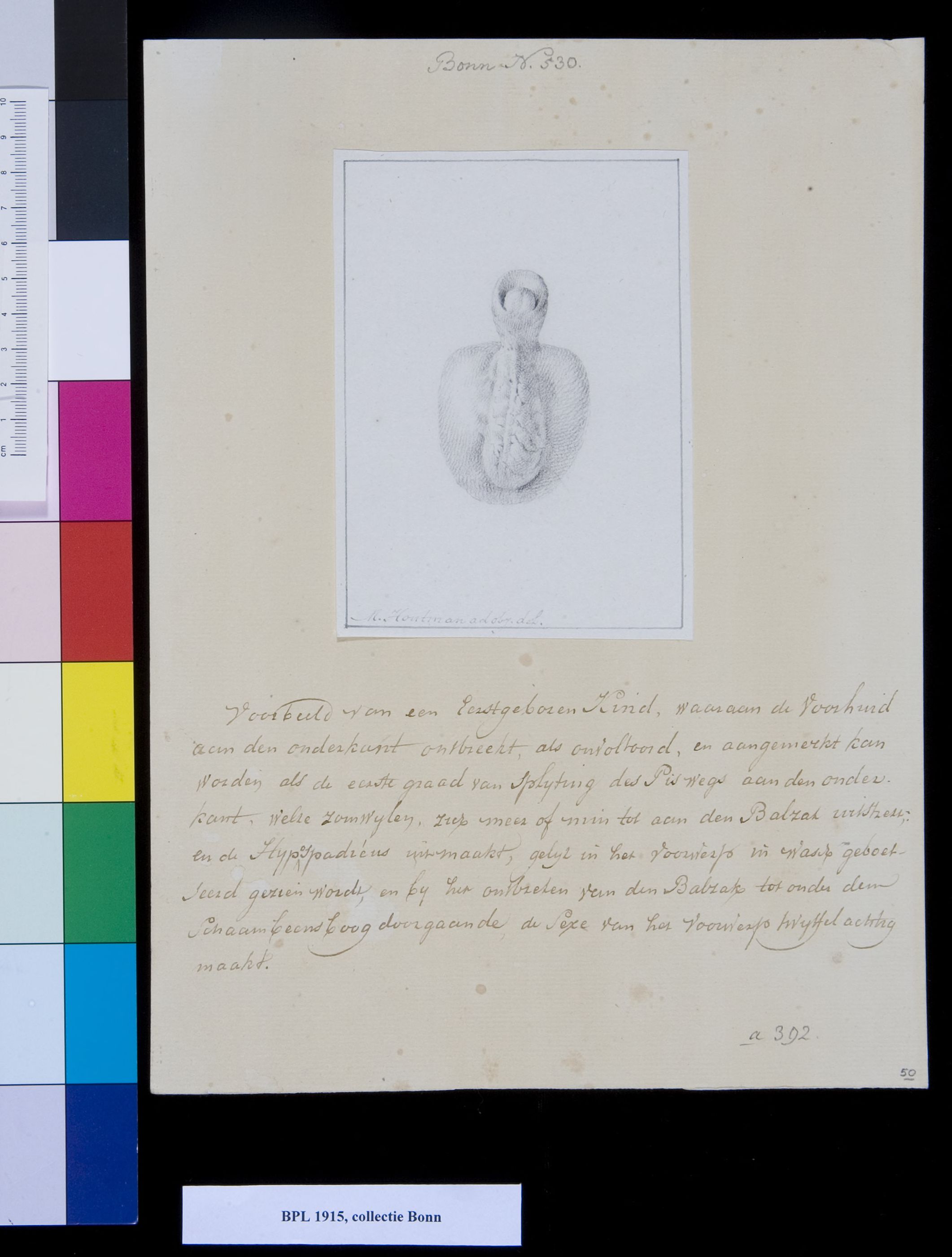 Scrotum, genitals
