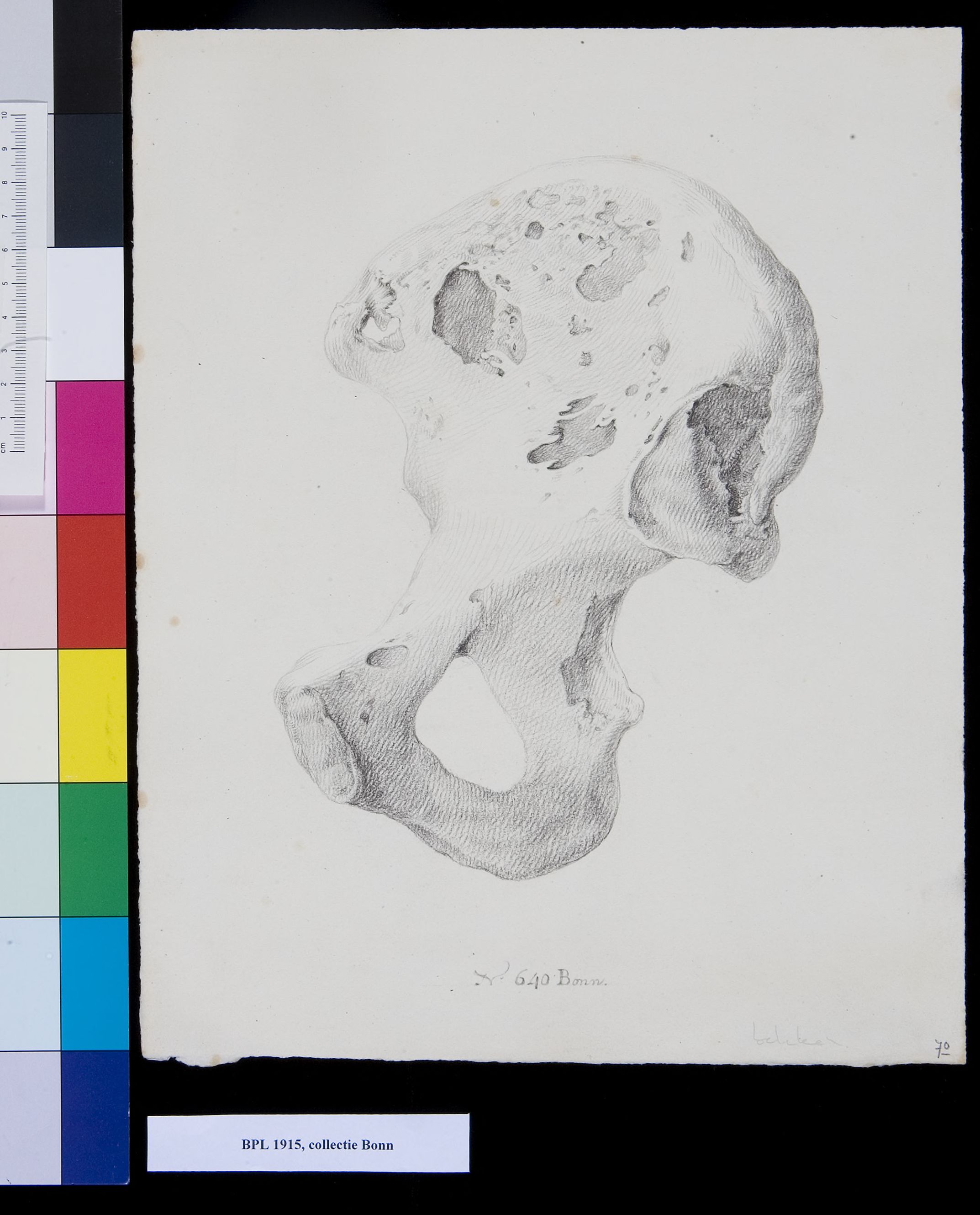 Pelvis