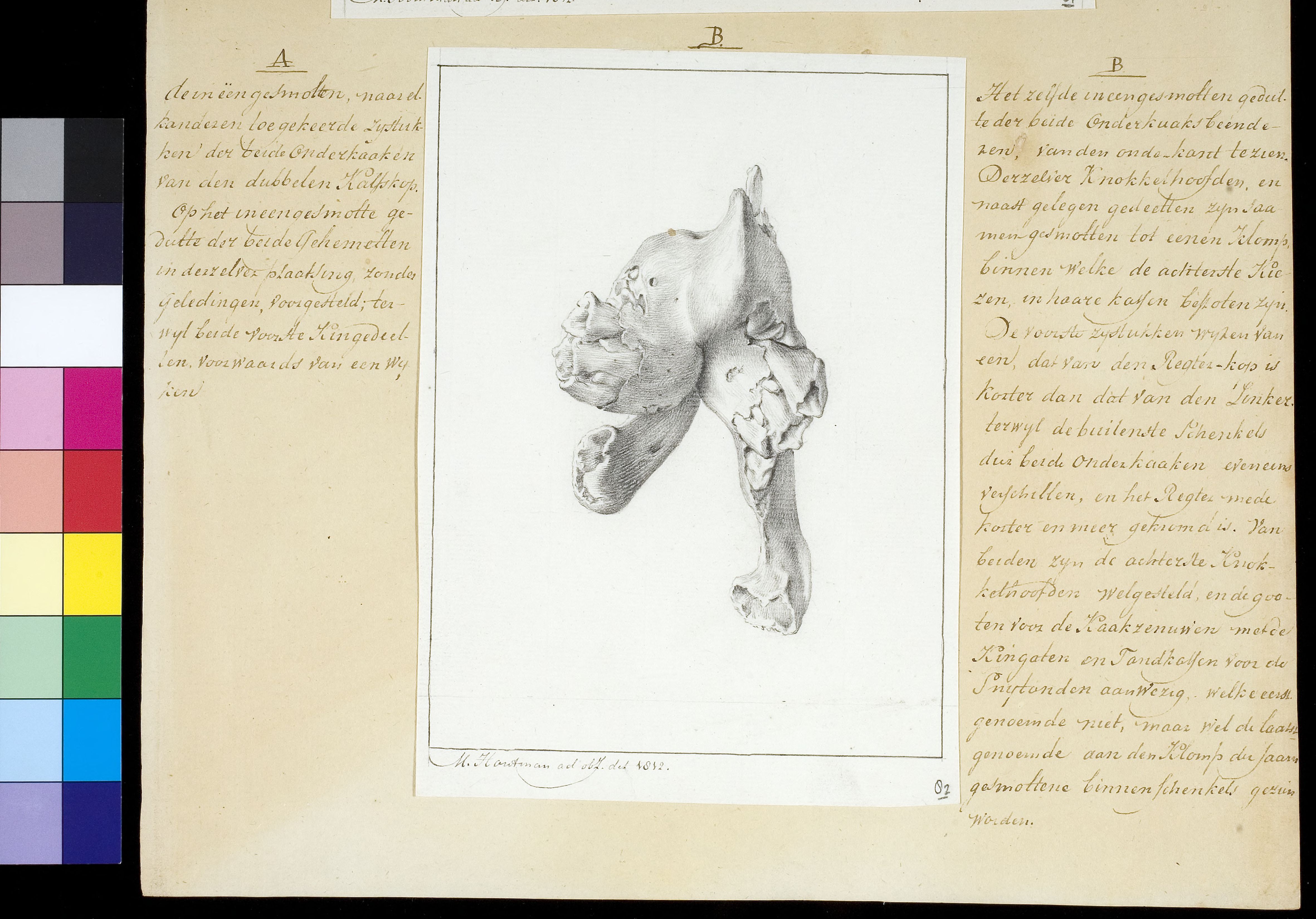 Animals: skull of calf with two heads
