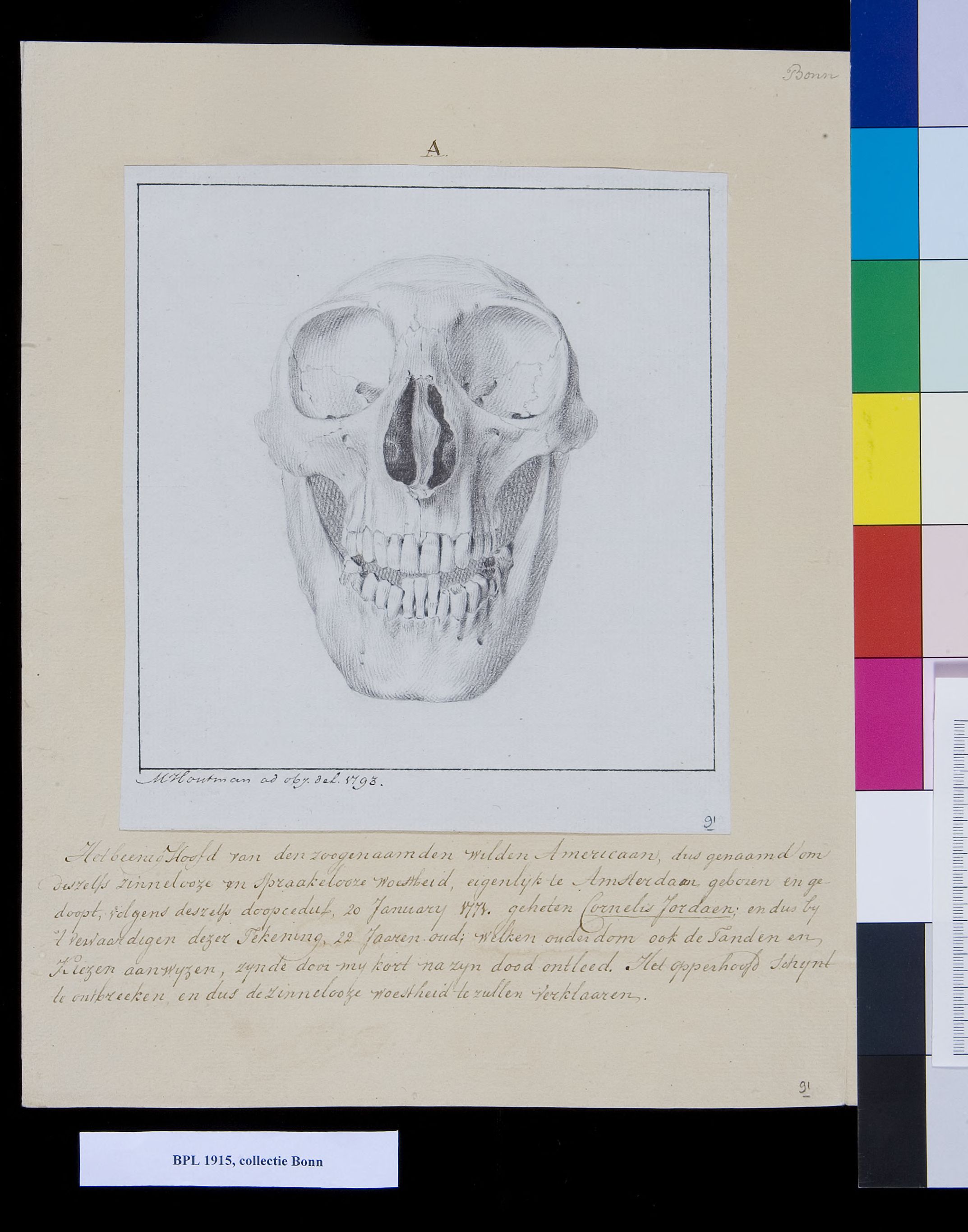 Skull, frontal view