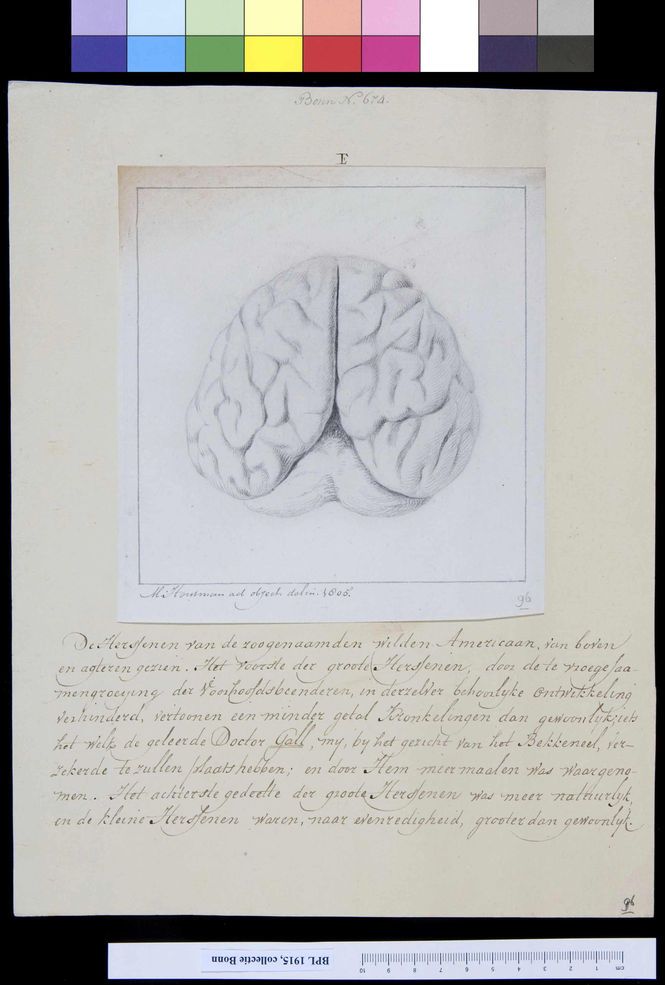 Brain