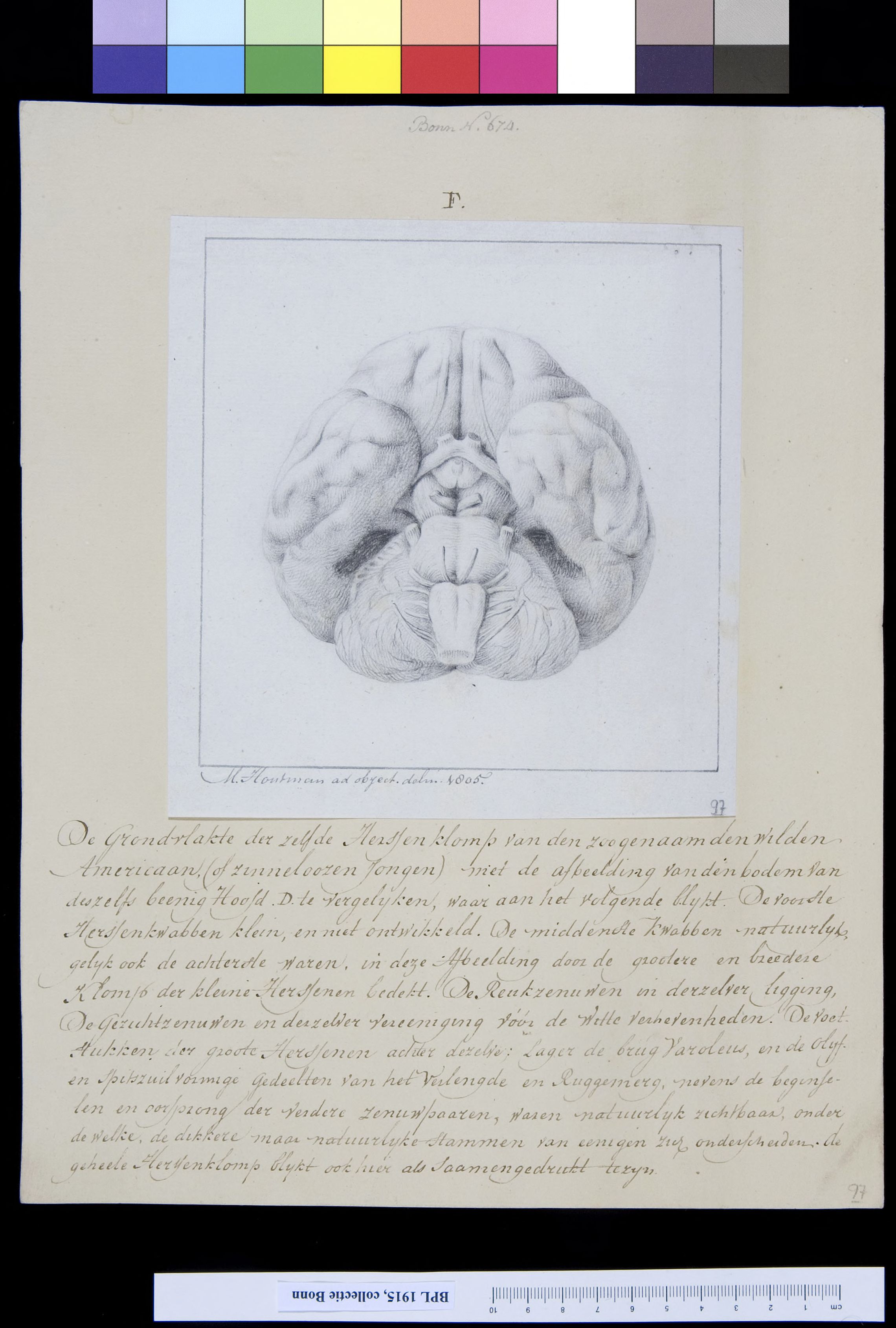 Brain