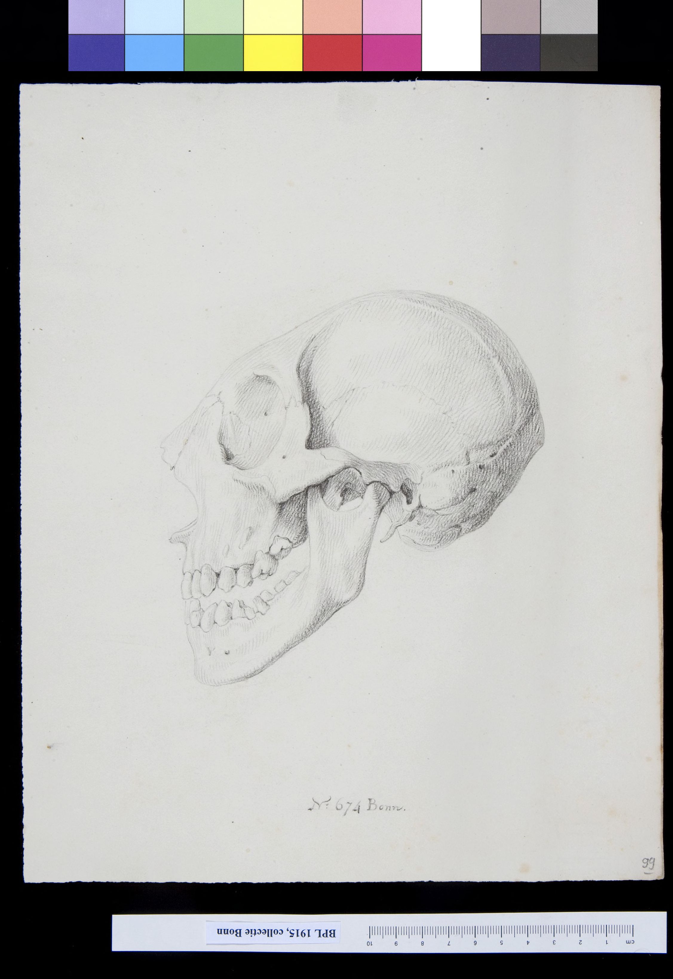 Skull, lateral view