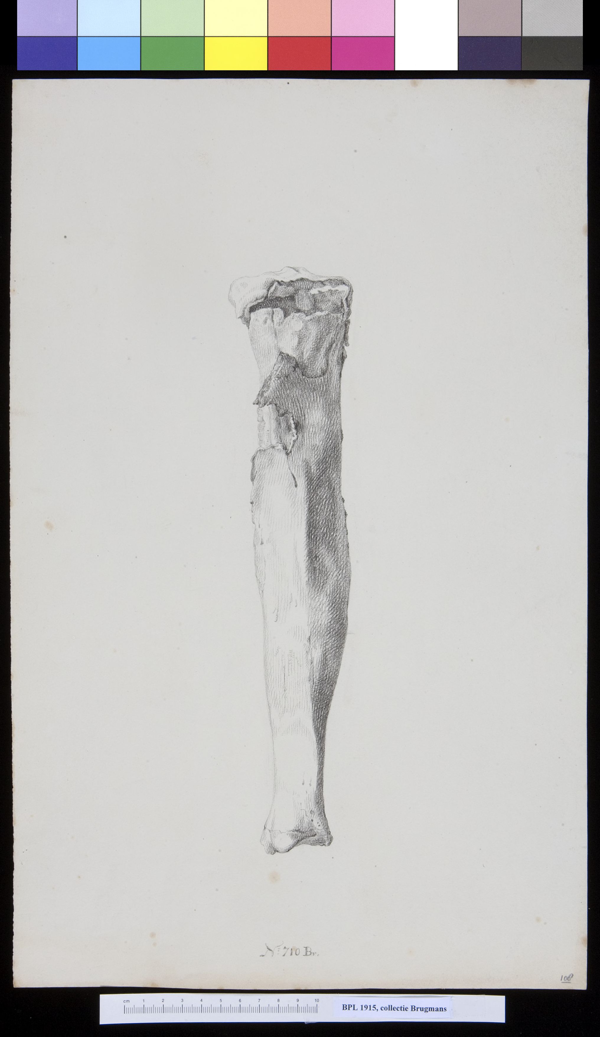 Bones of the lower leg (tibia and fibula)