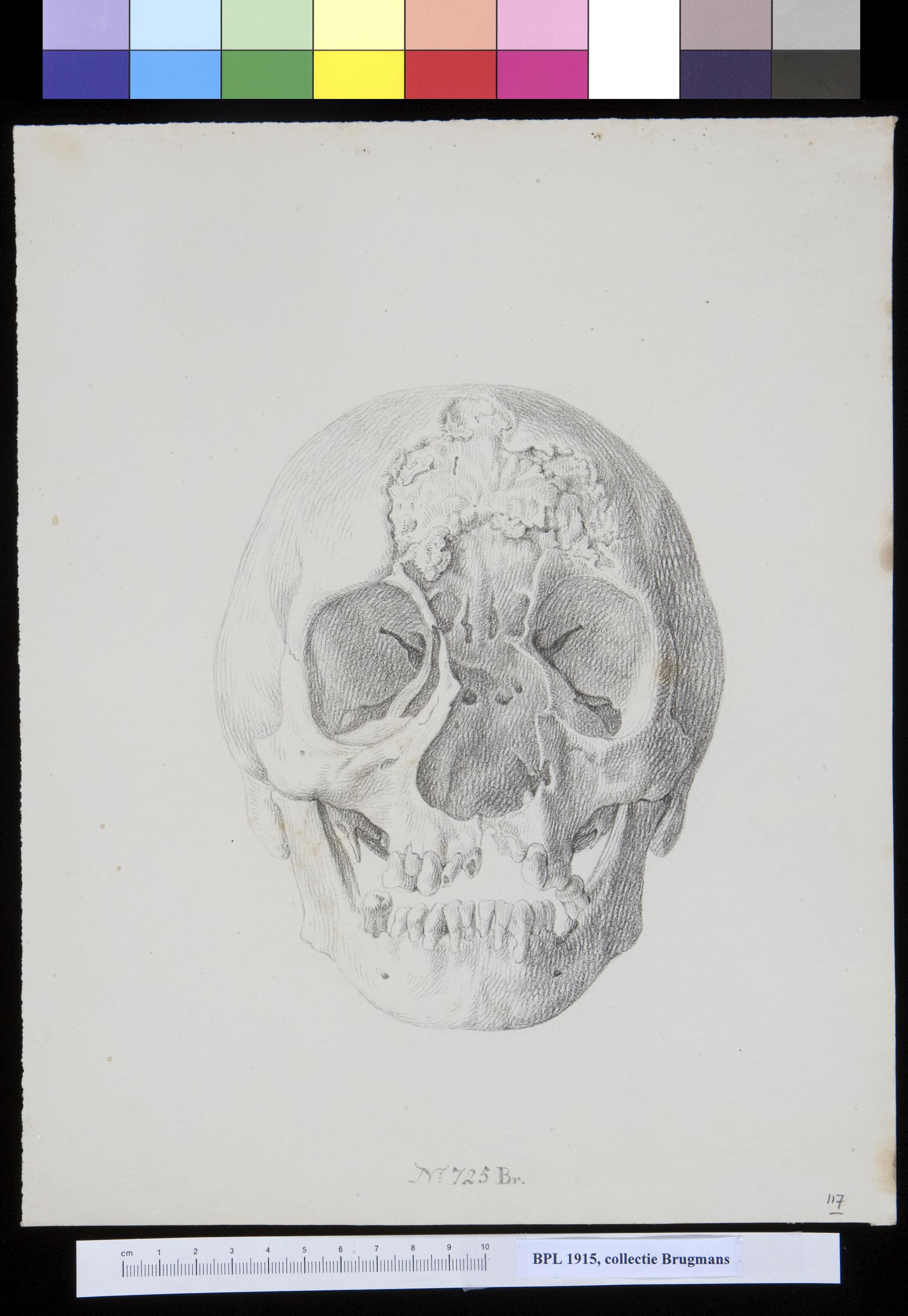 Skull, frontal view