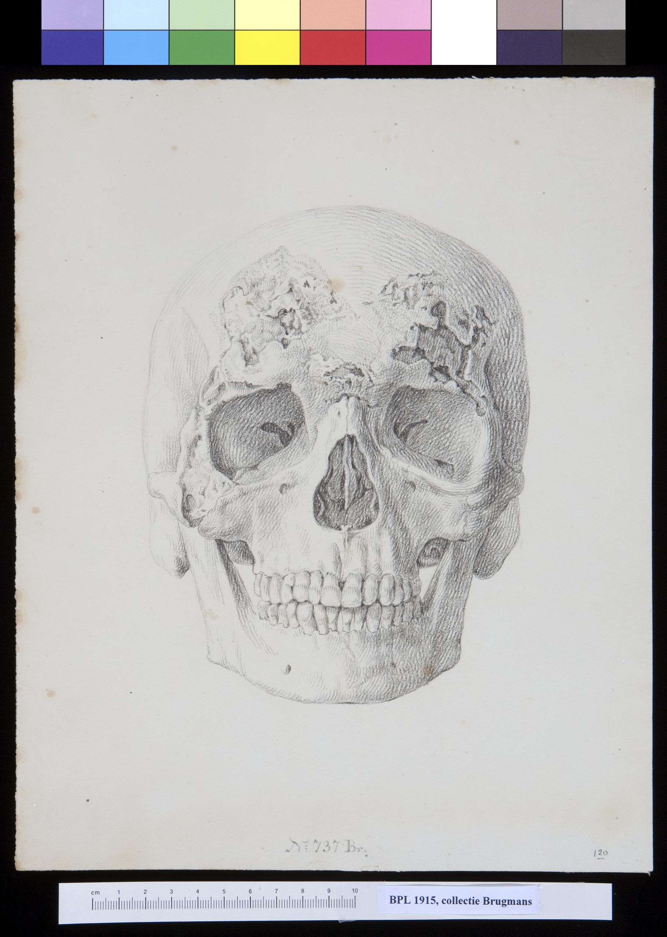 Skull, frontal view