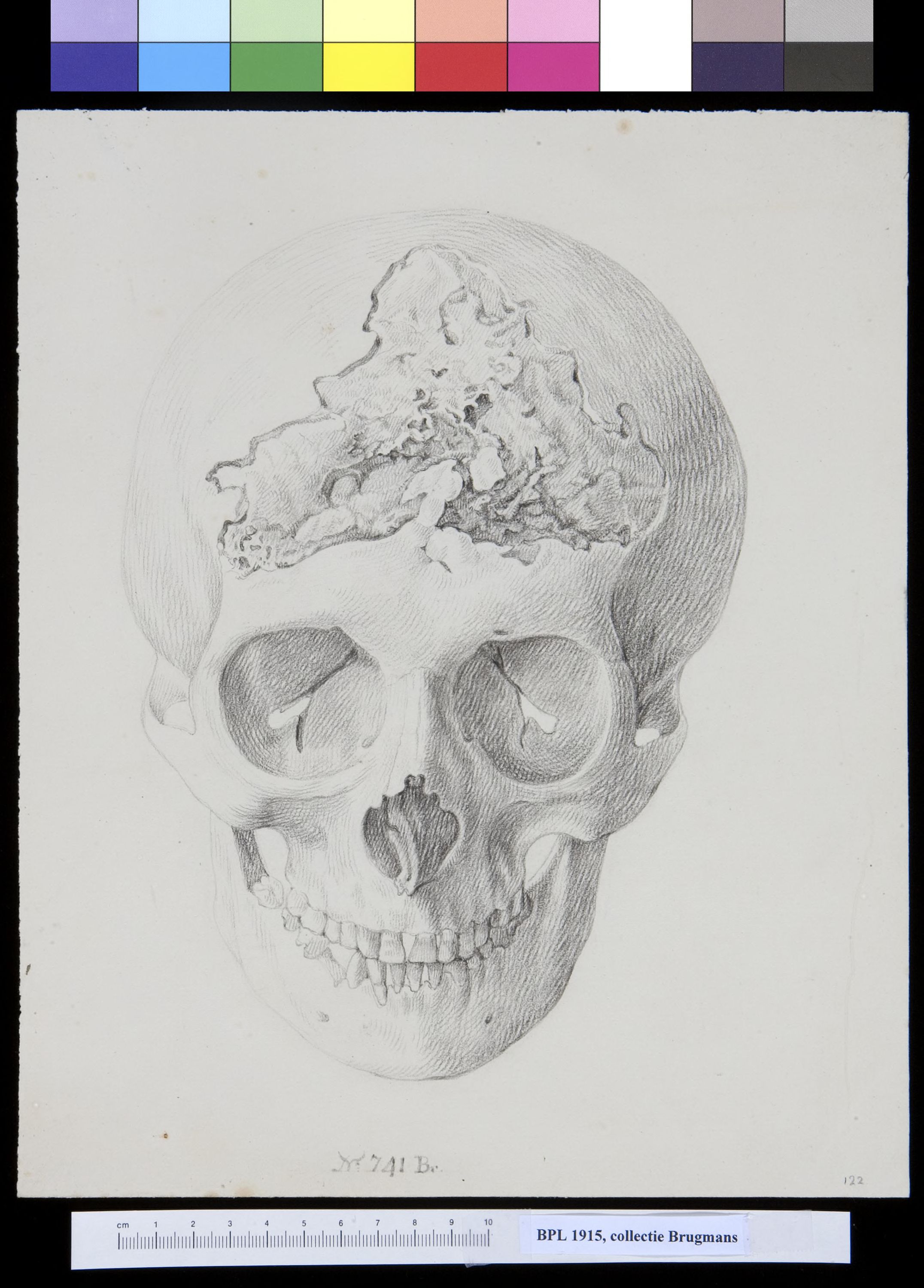 Skull, view from above