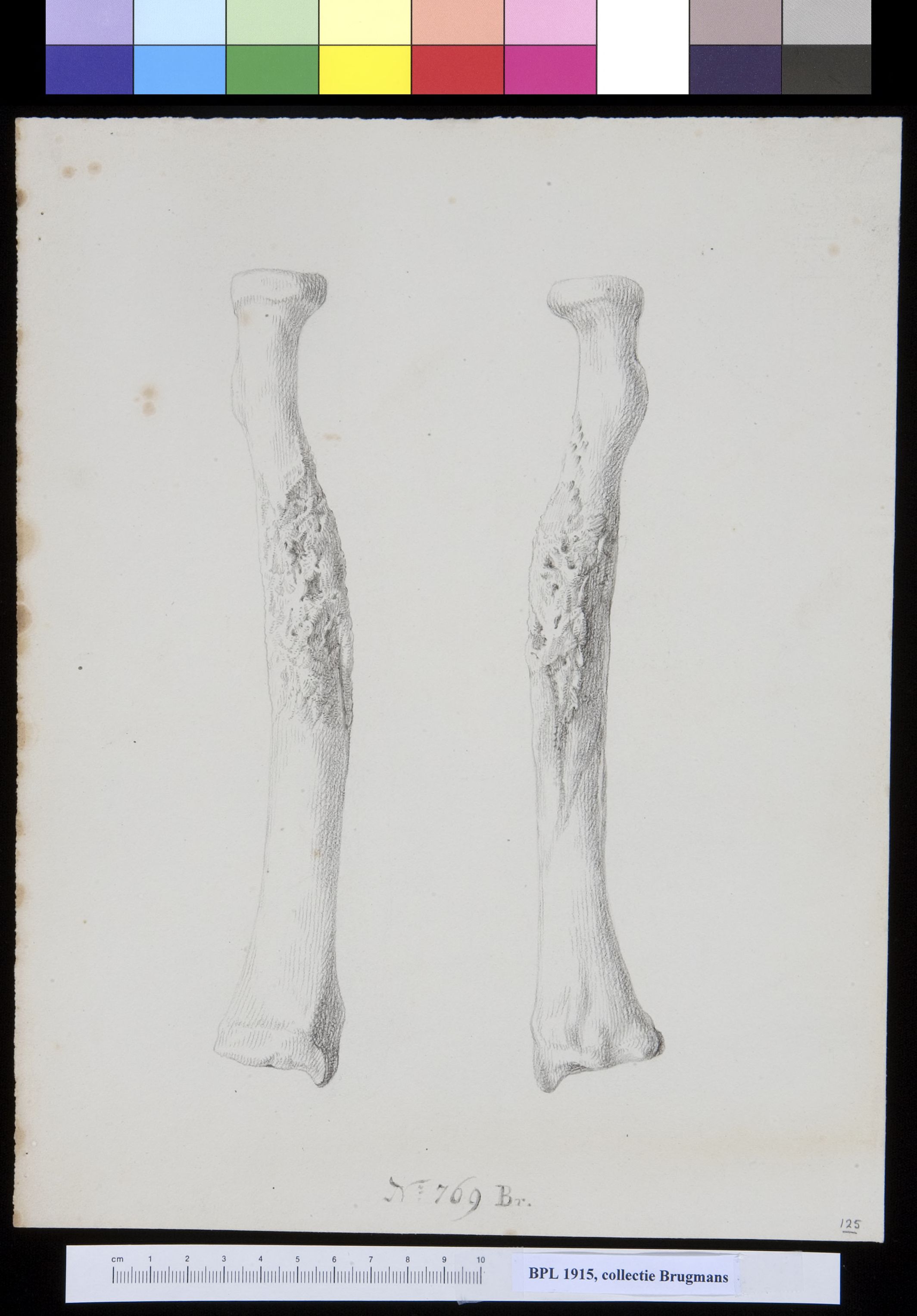 Bones of the lower arm