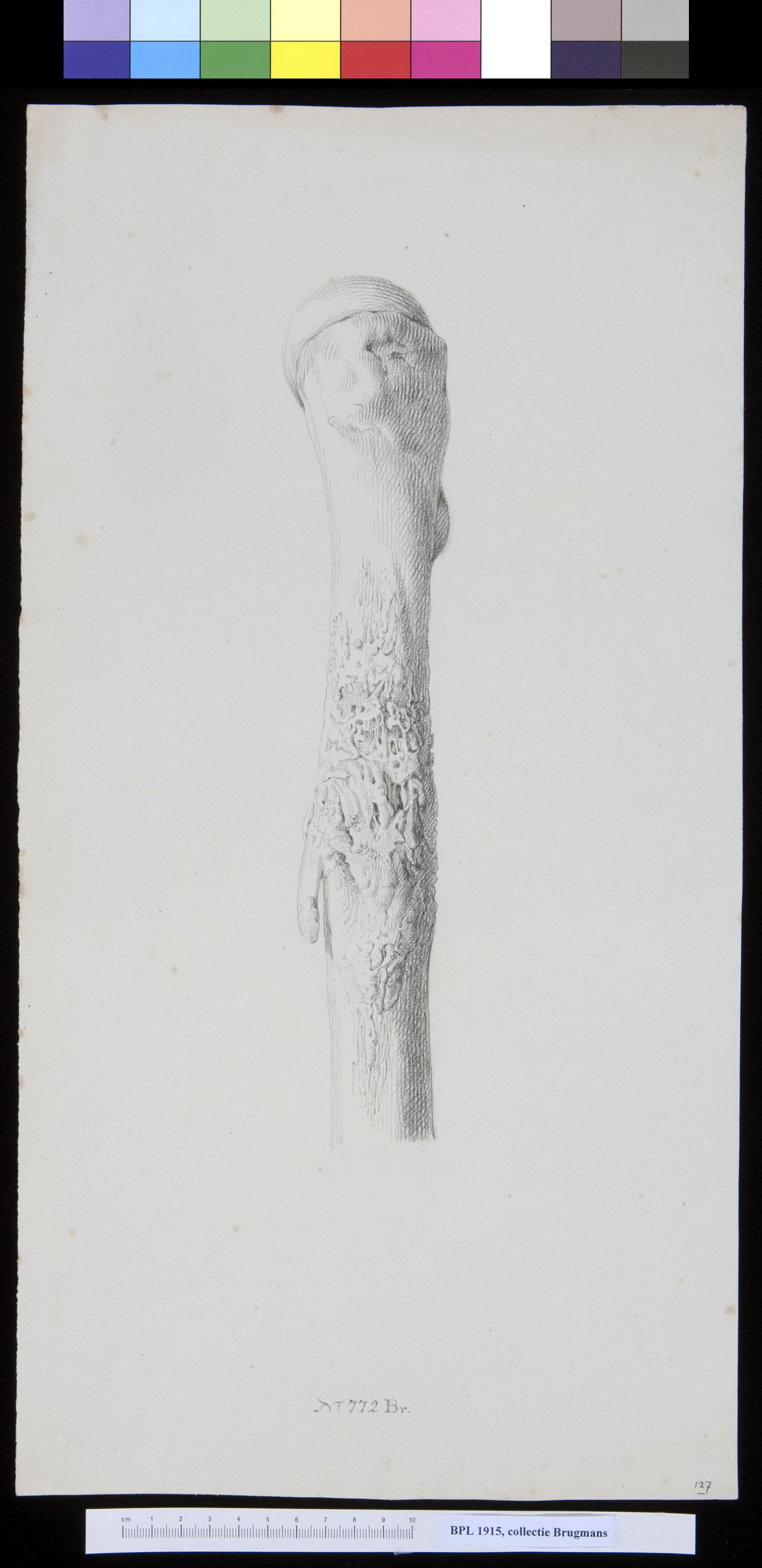 Bones of the upper leg (femur)